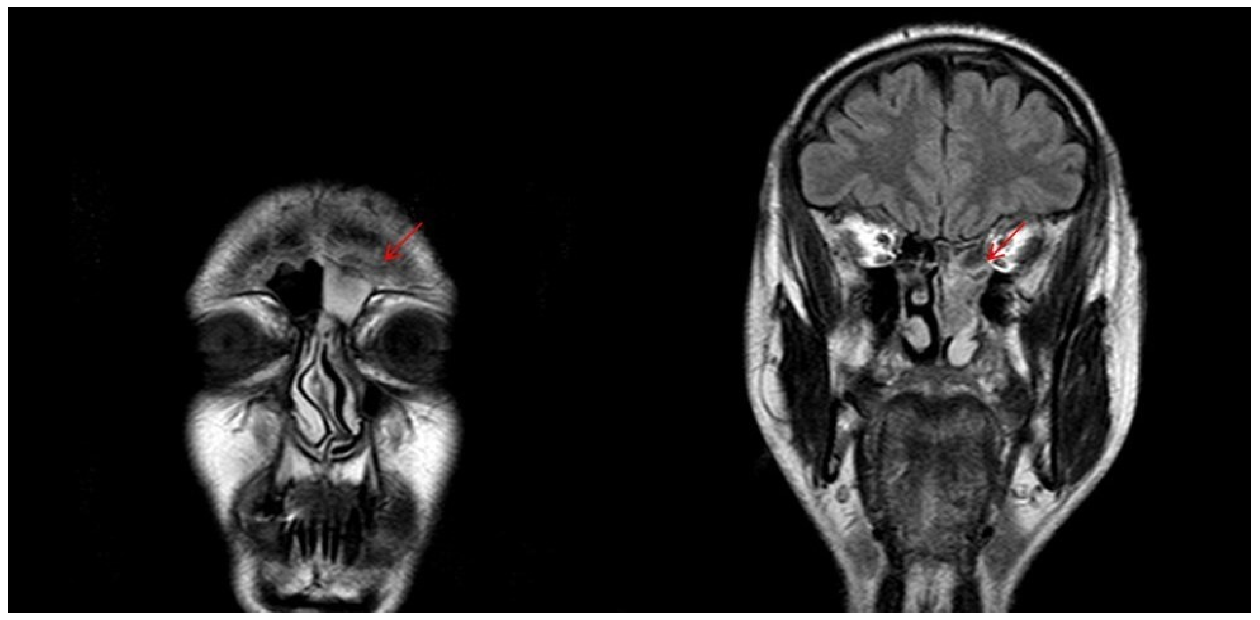 Curroncol 28 00222 g007