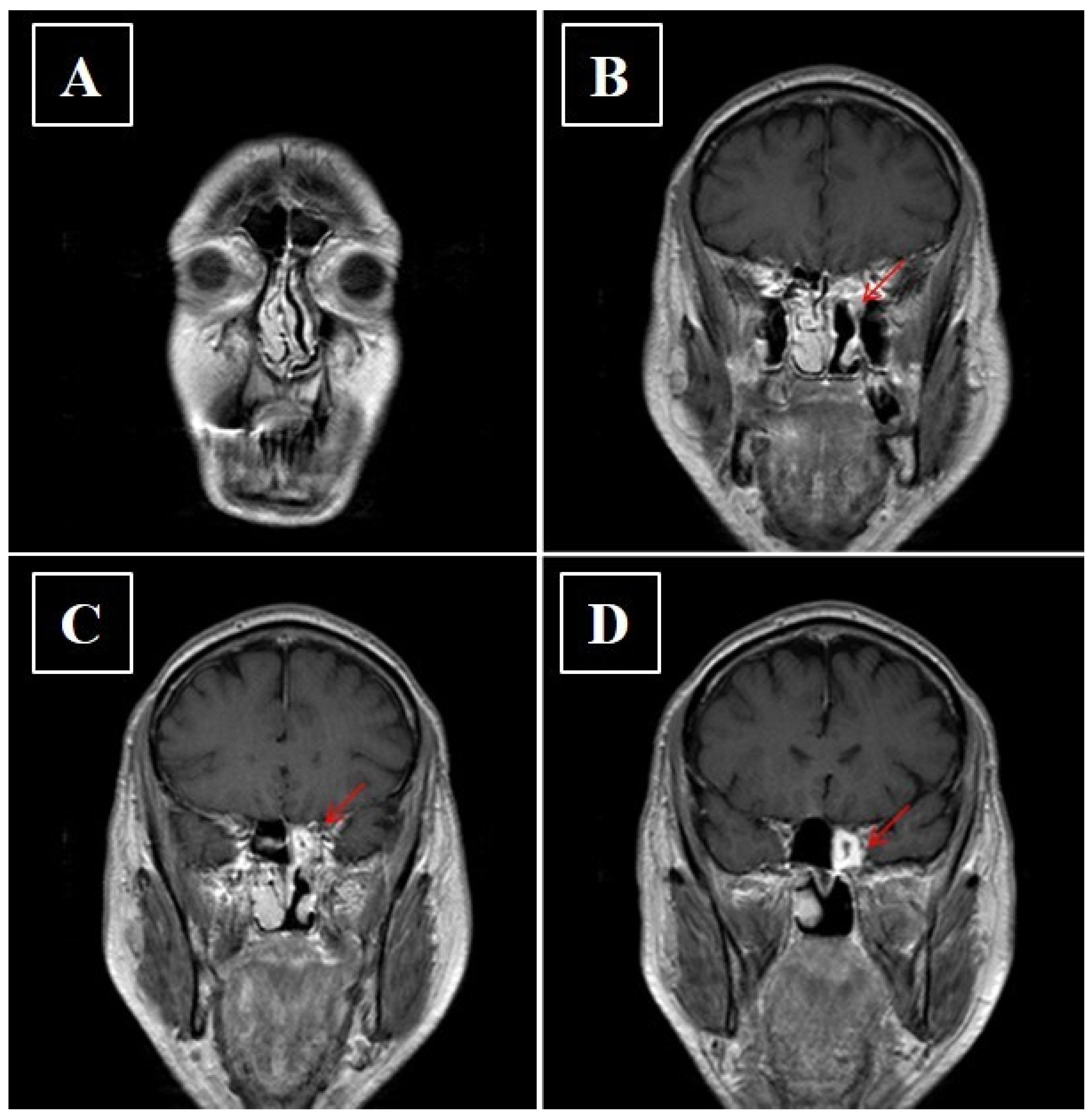 Curroncol 28 00222 g008