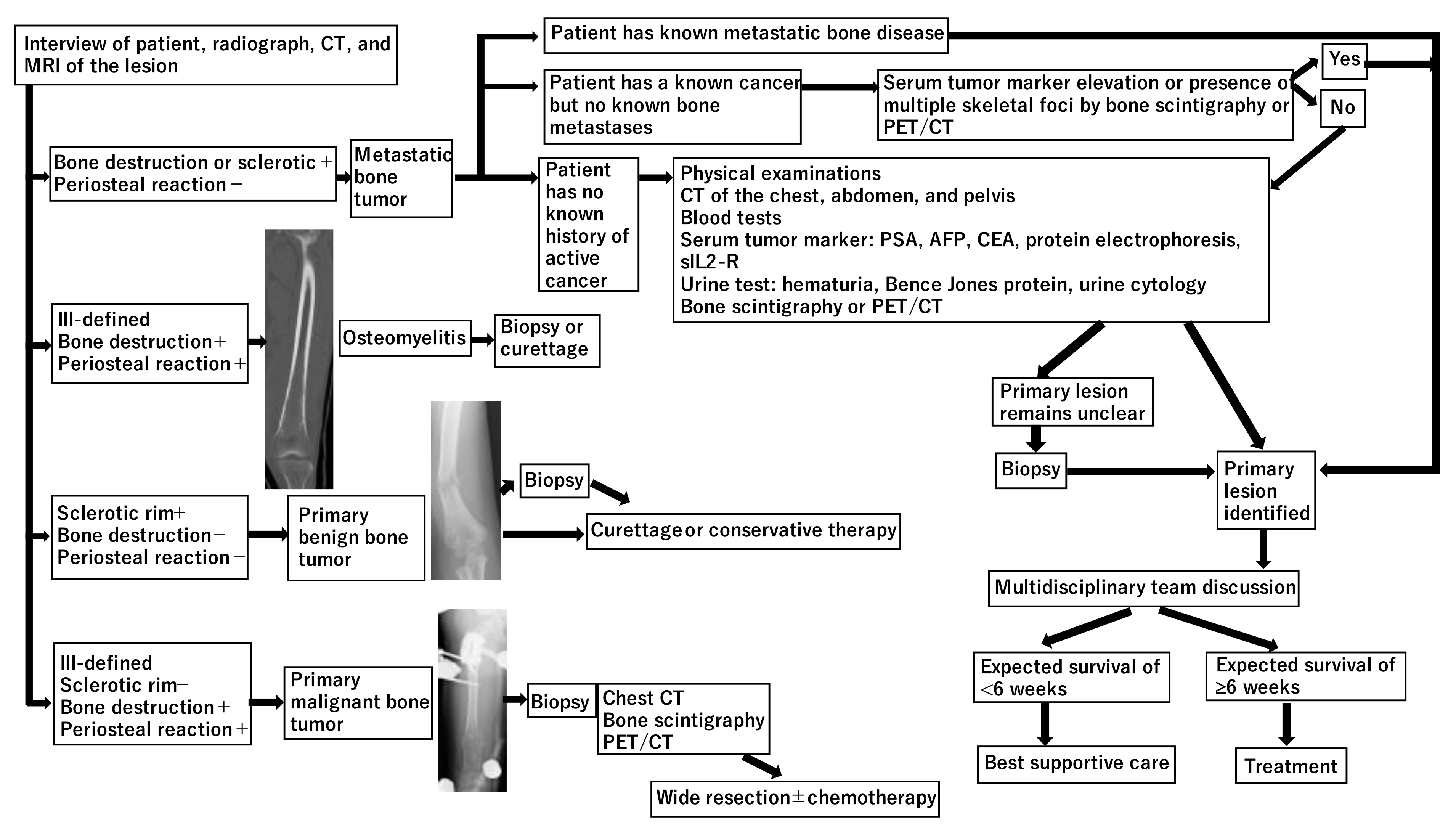 Current Oncology | Free Full-Text | Current Overview of Treatment for  Metastatic Bone Disease