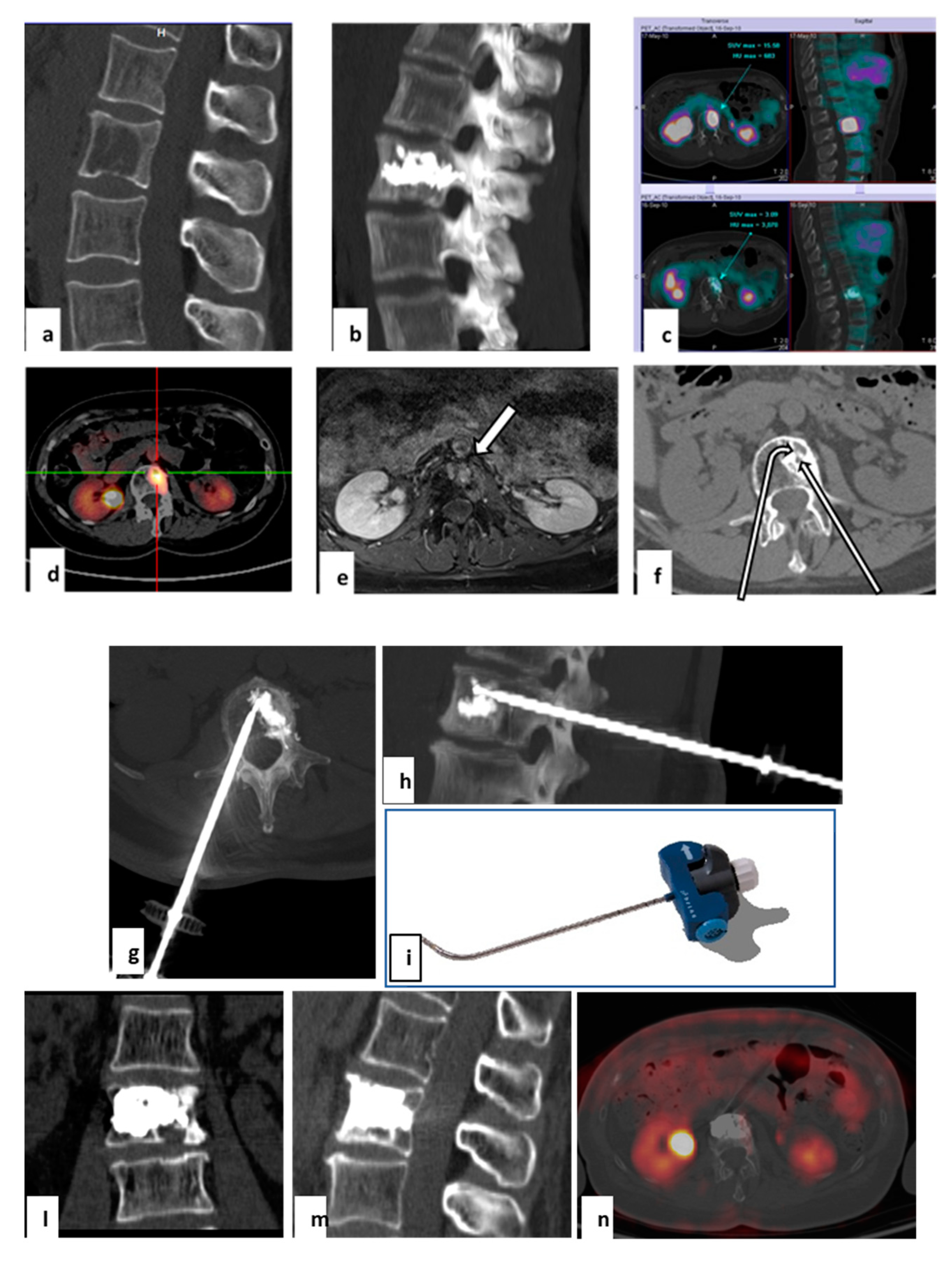 Curroncol 28 00340 g004