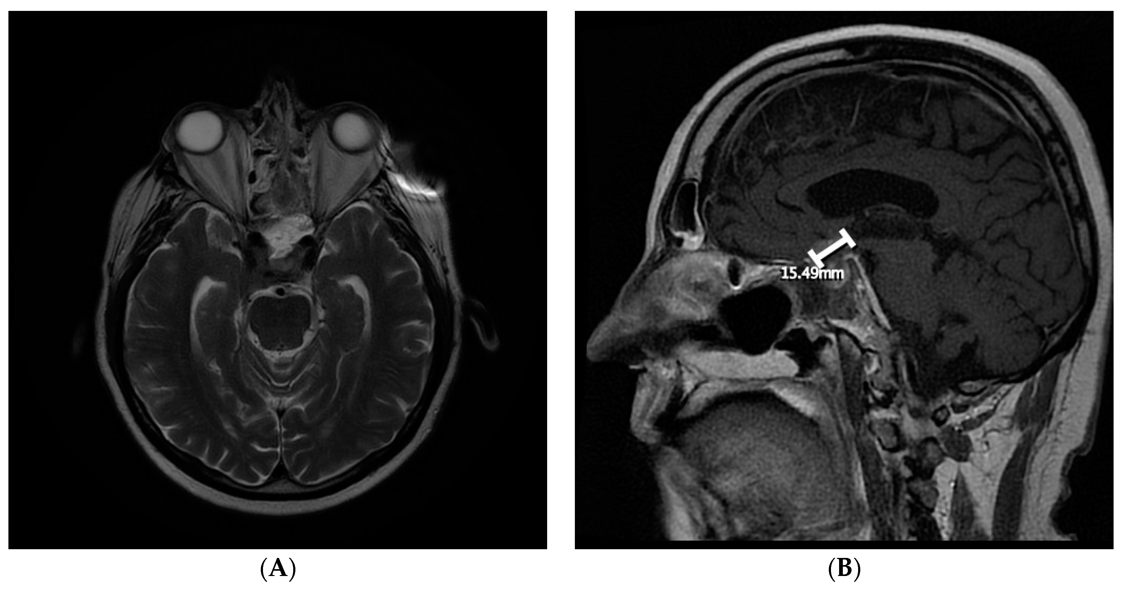 Curroncol 28 00365 g003
