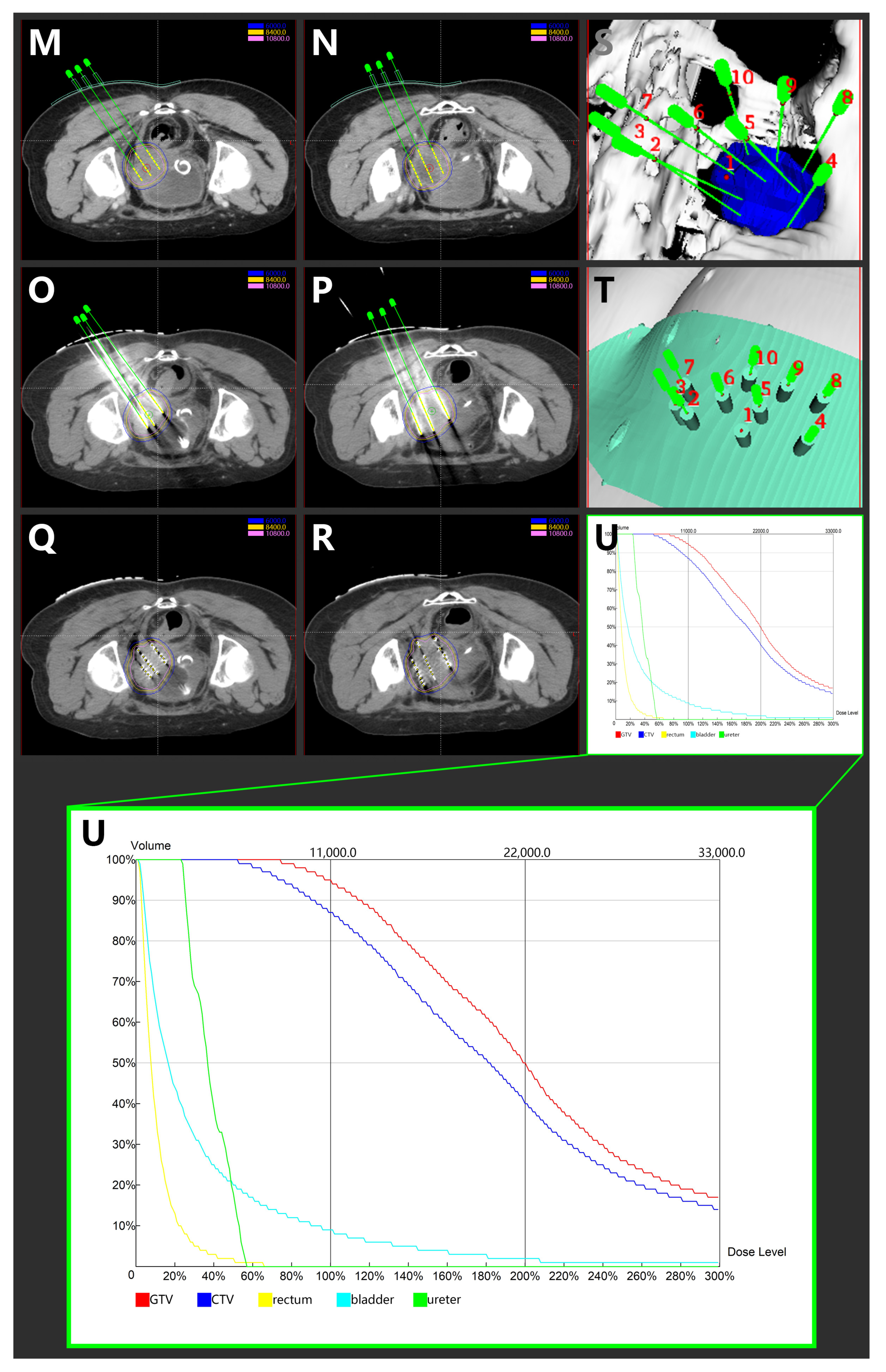 Curroncol 28 00387 g002b