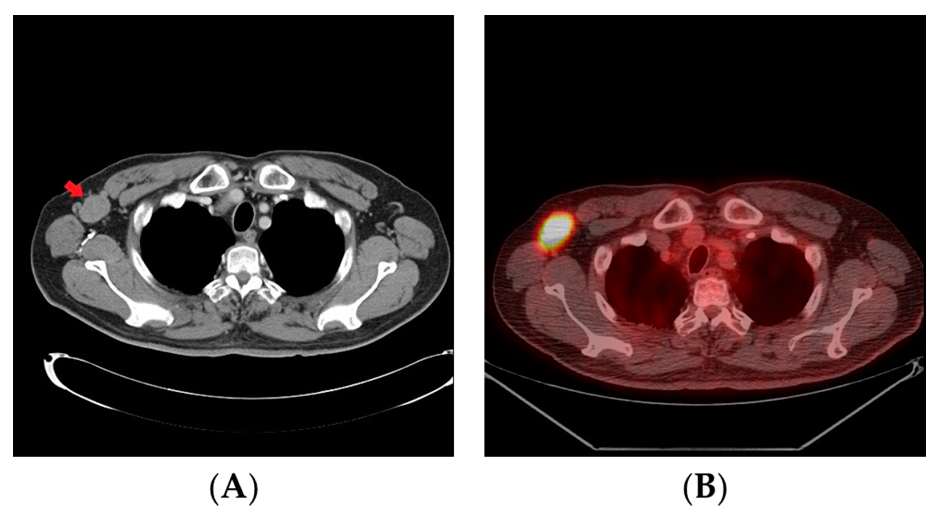 Curroncol 28 00388 g003
