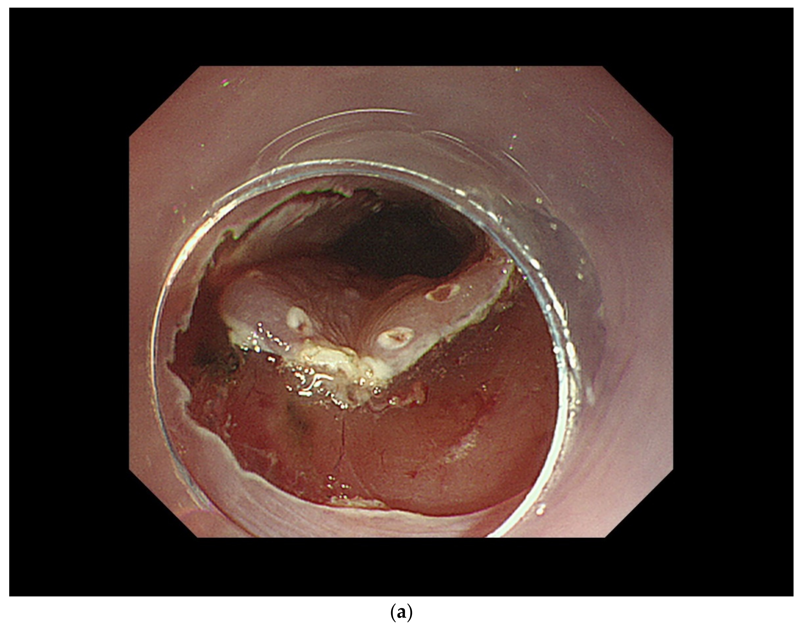 Curroncol 29 00048 g003a Curroncol 29 00048 g003a