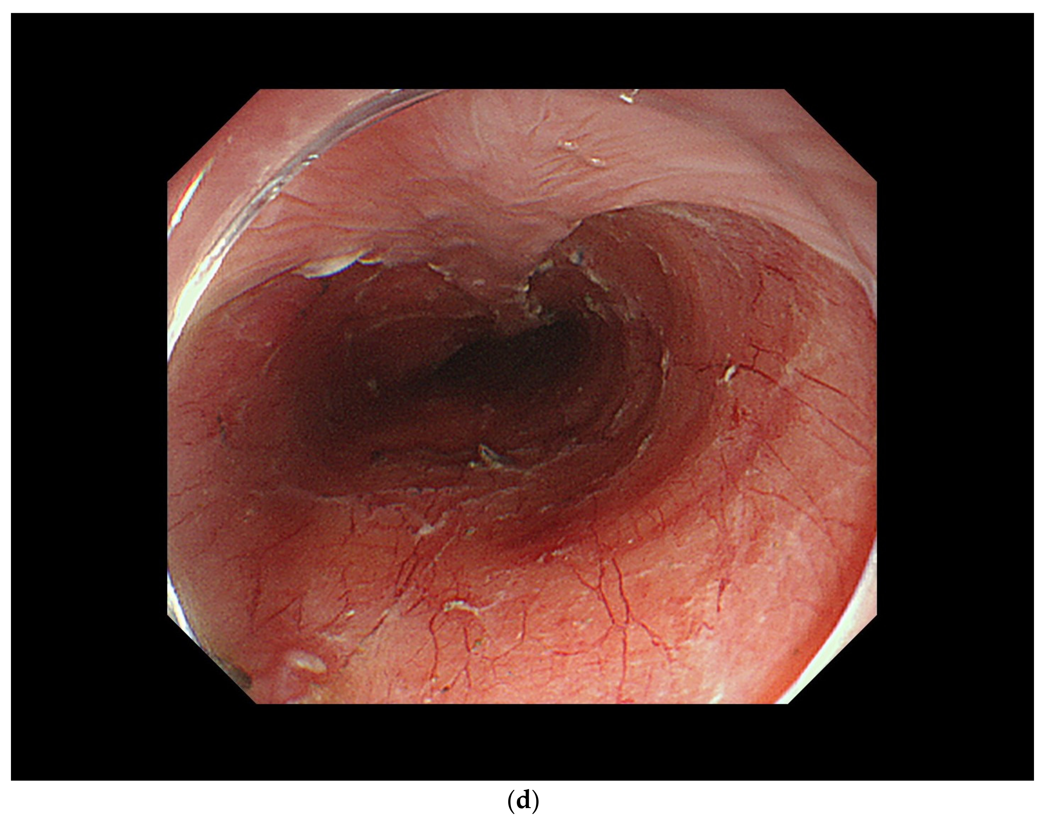 Curroncol 29 00048 g003c Curroncol 29 00048 g003c