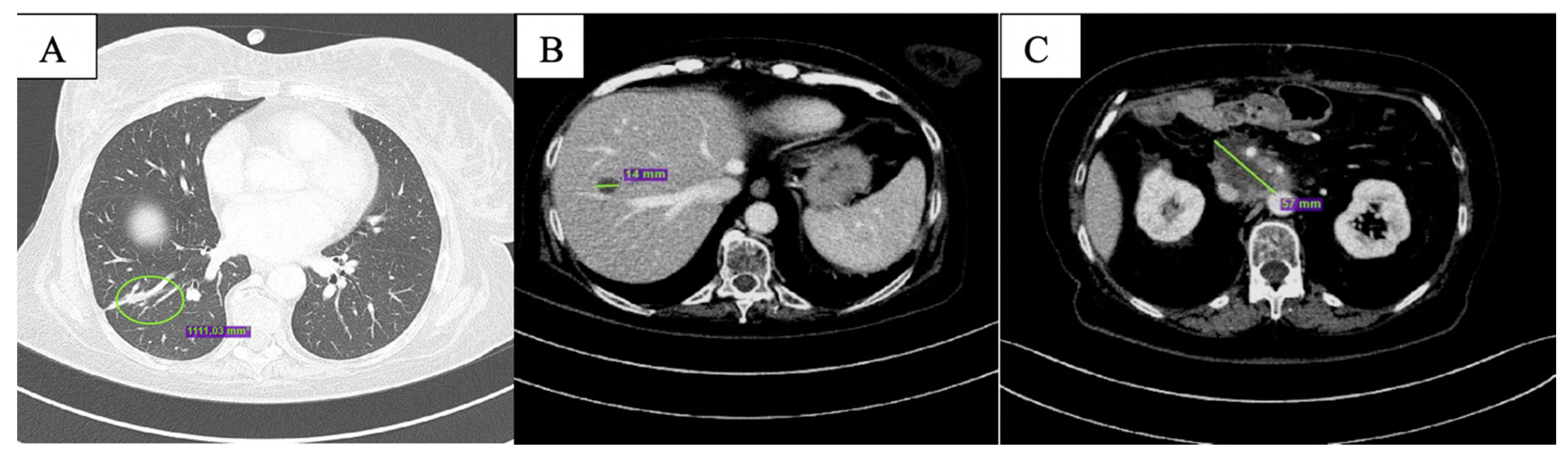 Curroncol 29 00049 g002 550