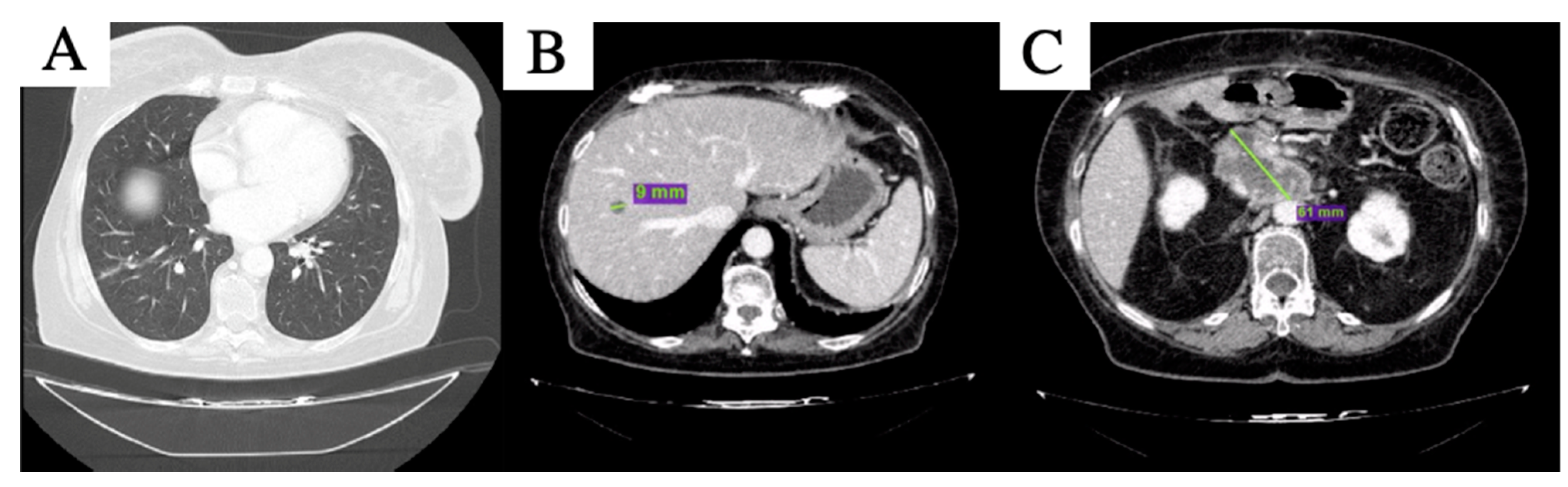 Curroncol 29 00049 g003 550