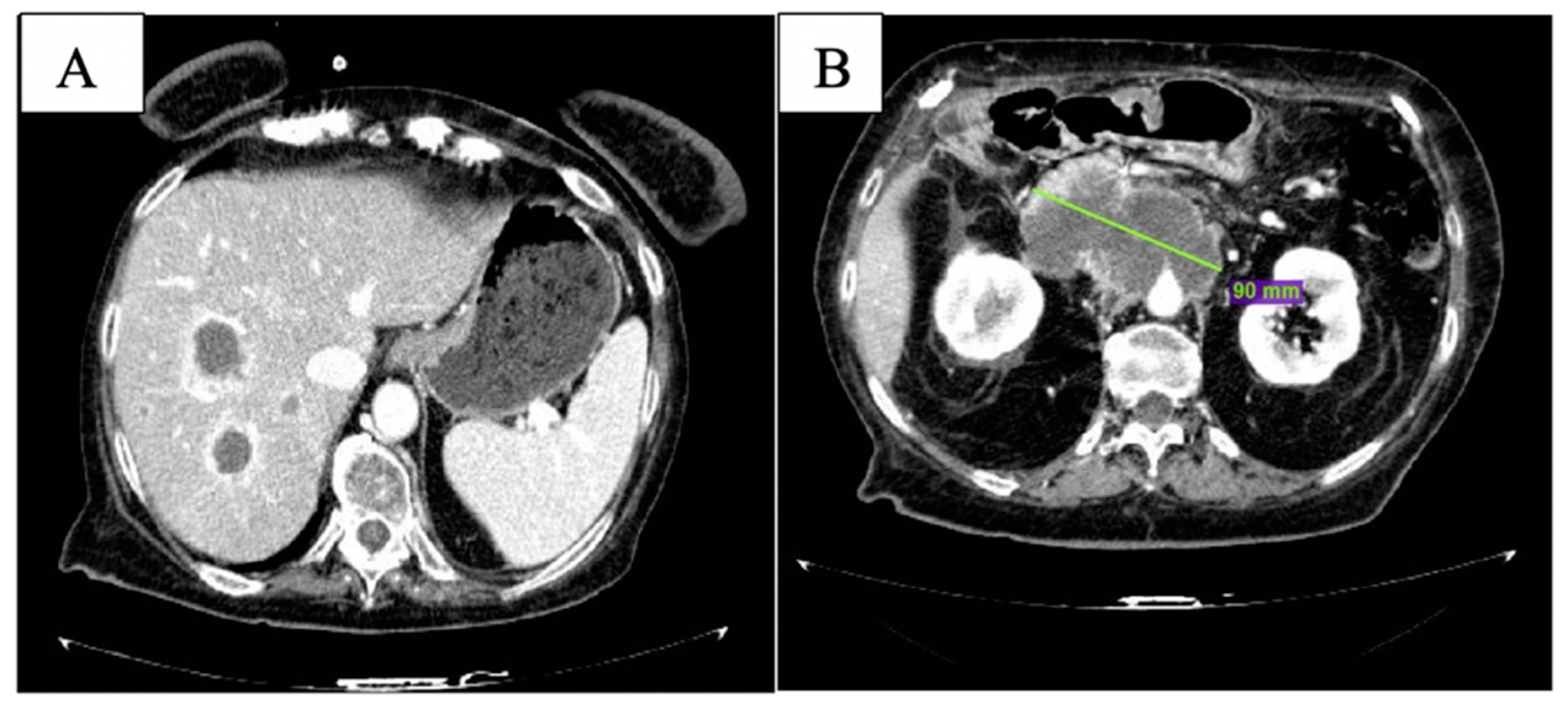 Curroncol 29 00049 g004 550