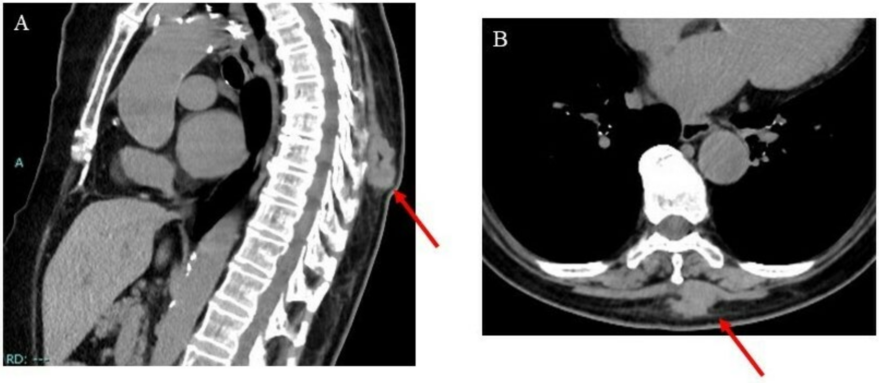 Curroncol 29 00064 g001 Curroncol 29 00064 g001
