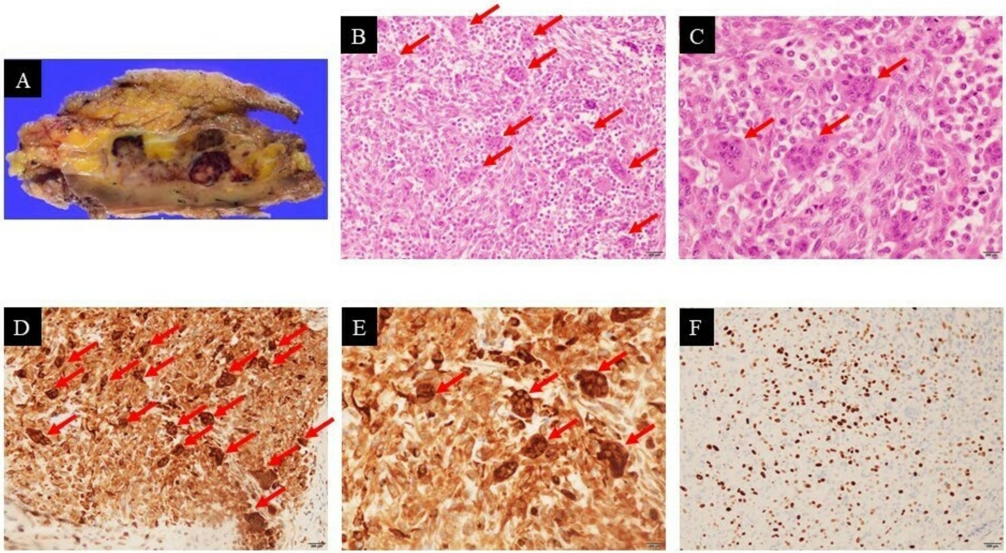 Curroncol 29 00064 g003 Curroncol 29 00064 g003