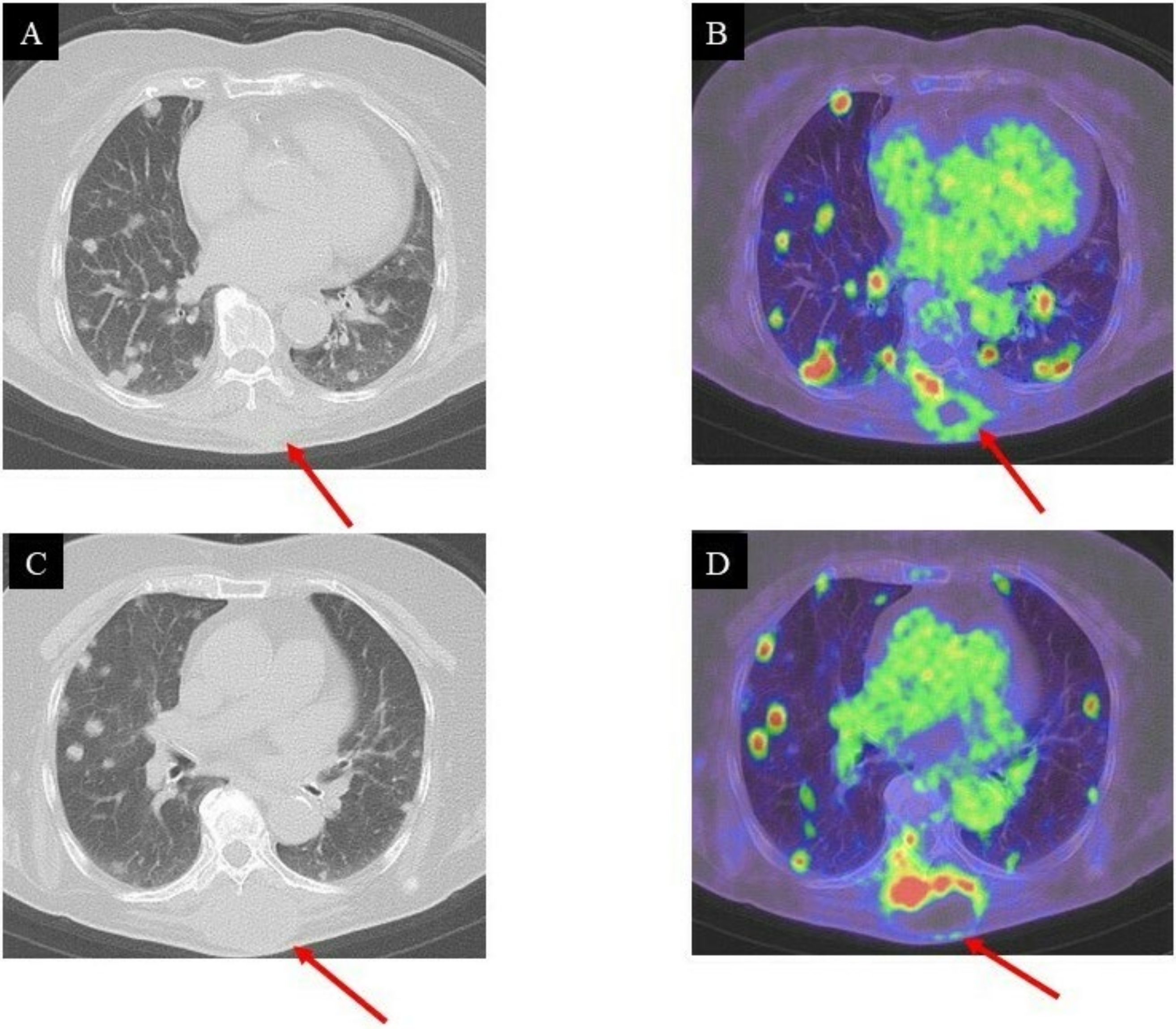 Curroncol 29 00064 g005 Curroncol 29 00064 g005