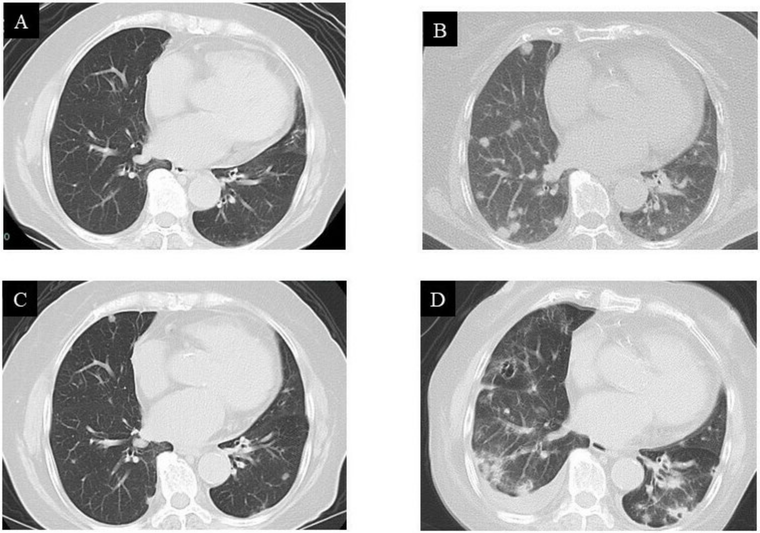 Curroncol 29 00064 g006 Curroncol 29 00064 g006