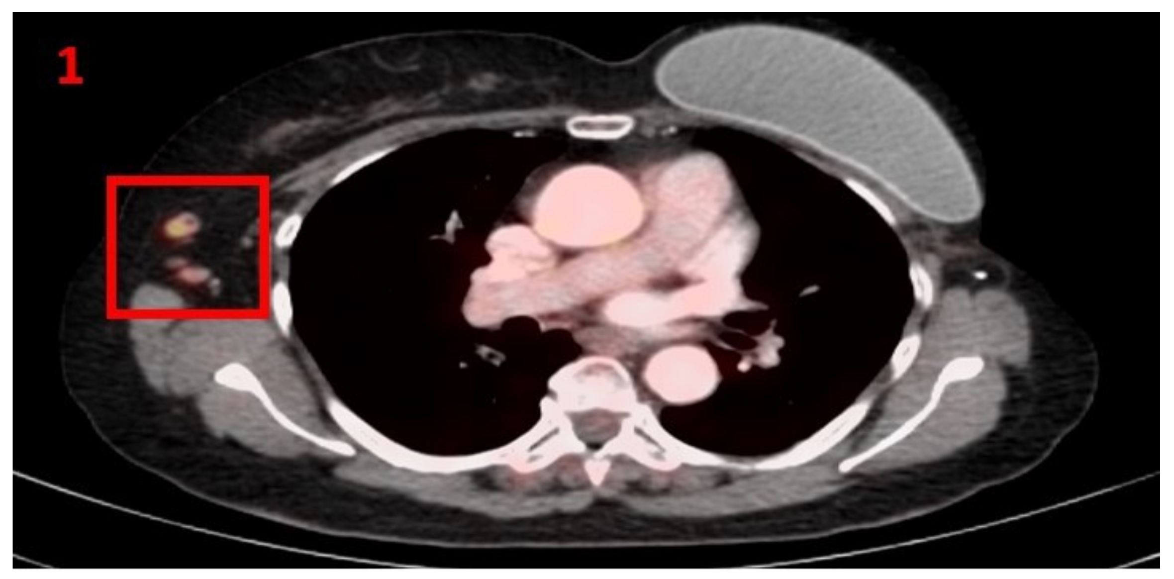 Curroncol 29 00084 g001 550