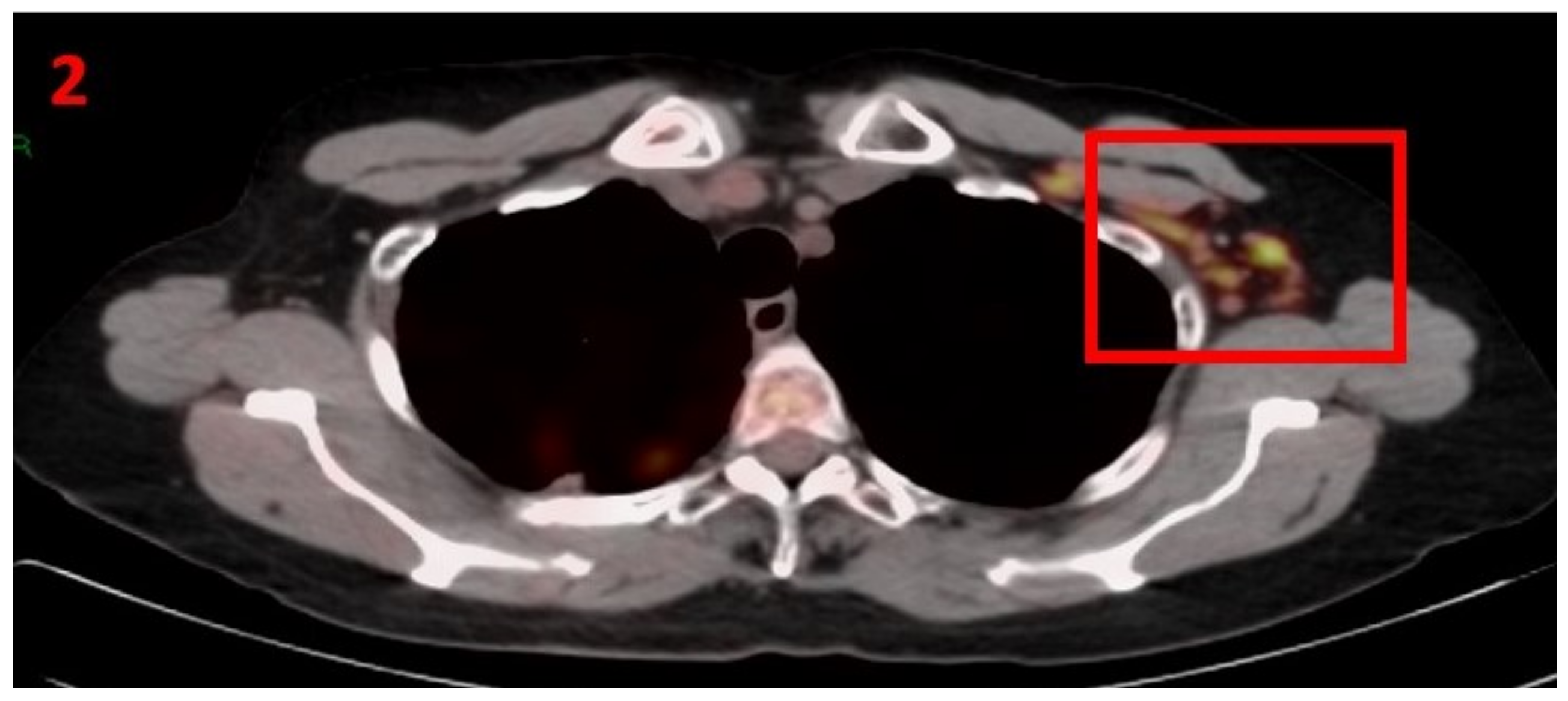Curroncol 29 00084 g002 550