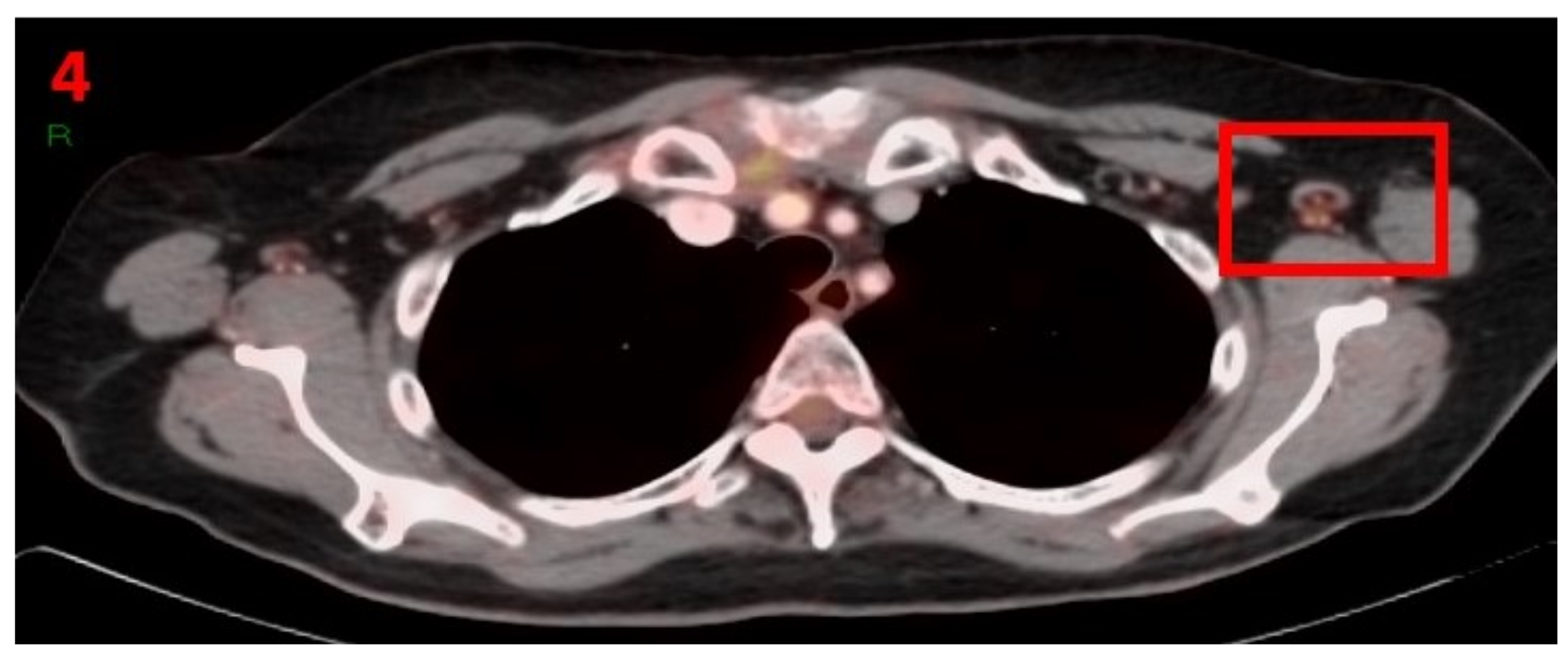 Curroncol 29 00084 g004 550