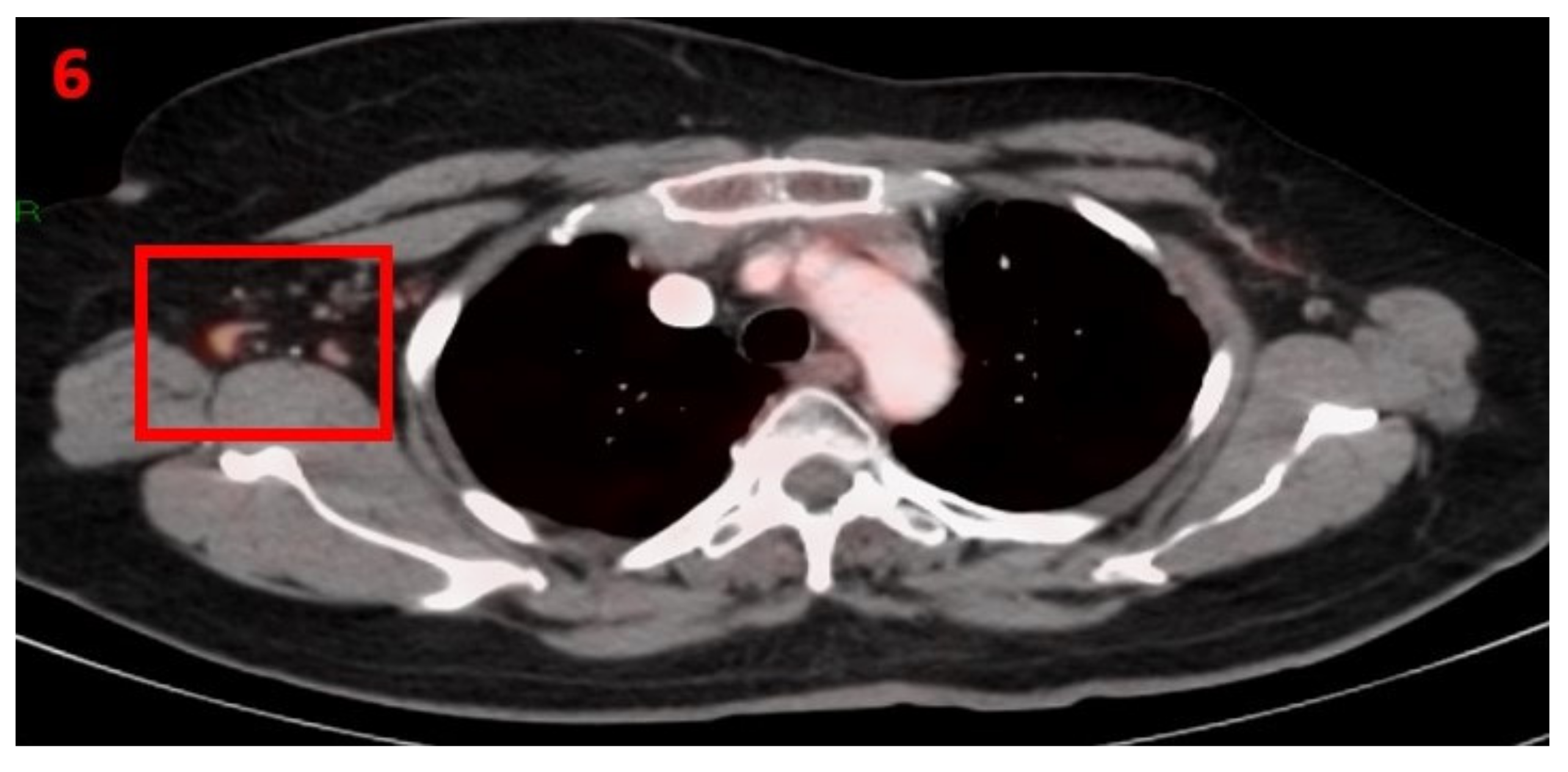 Curroncol 29 00084 g006 550