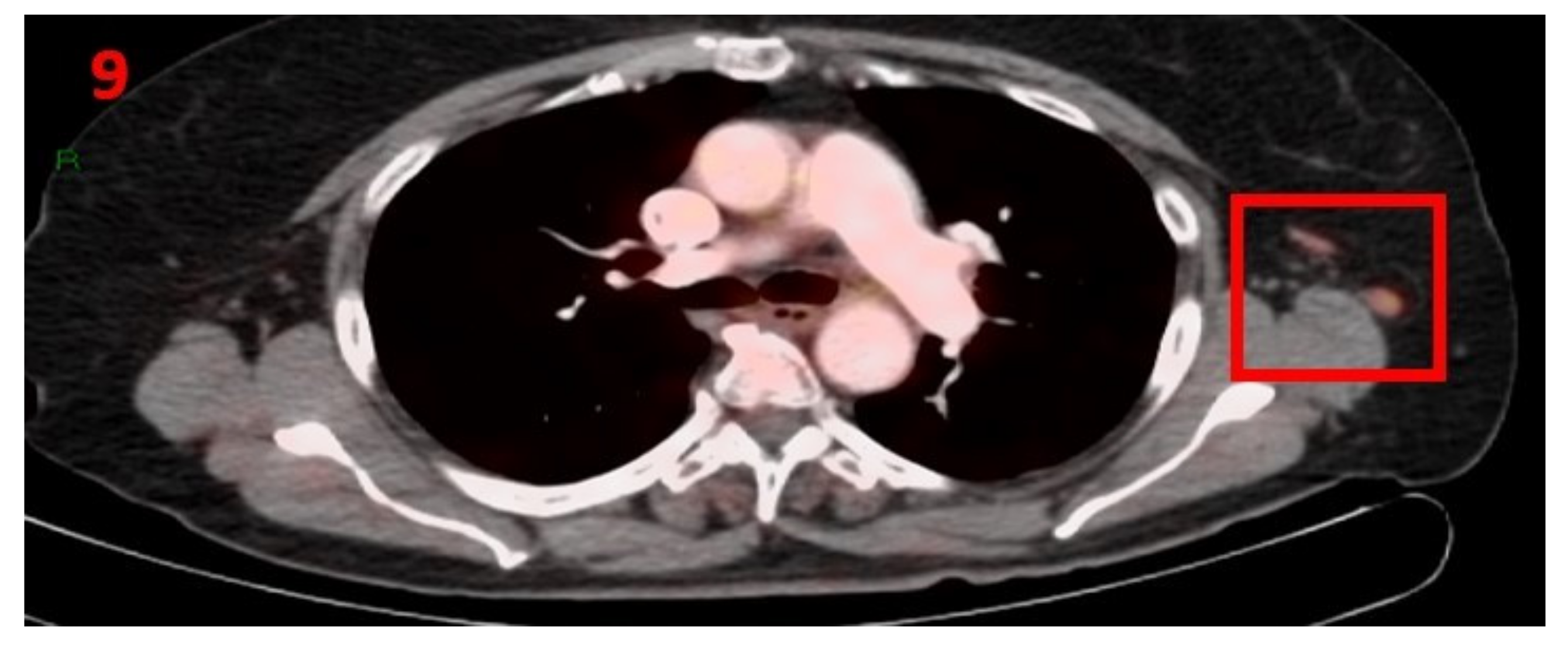 Curroncol 29 00084 g009 550