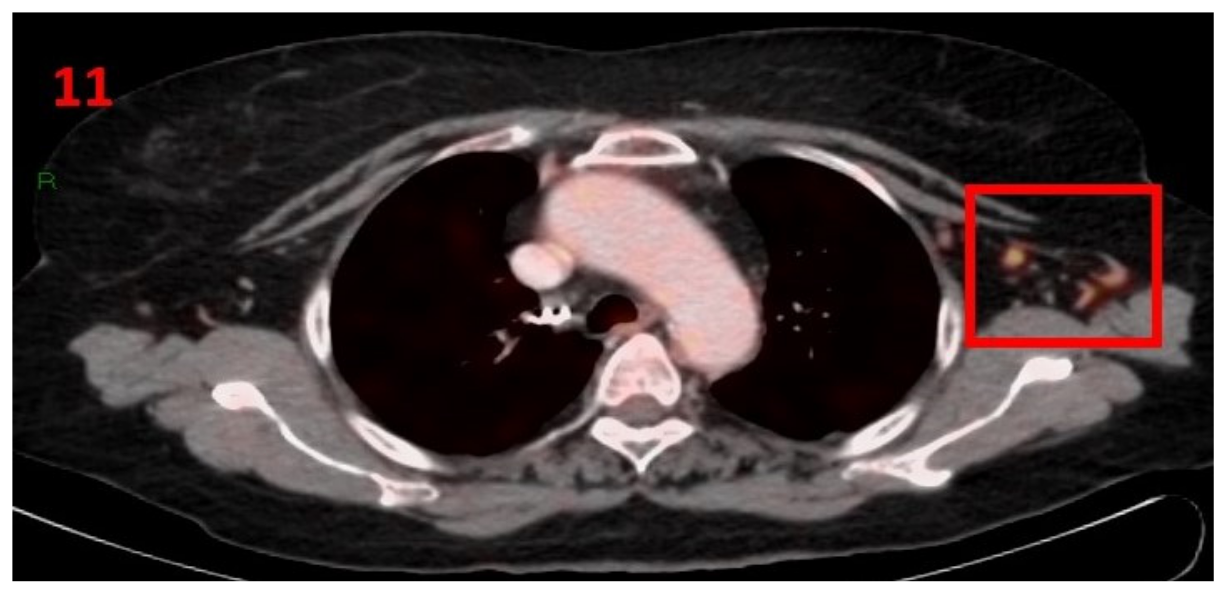 Curroncol 29 00084 g011 550