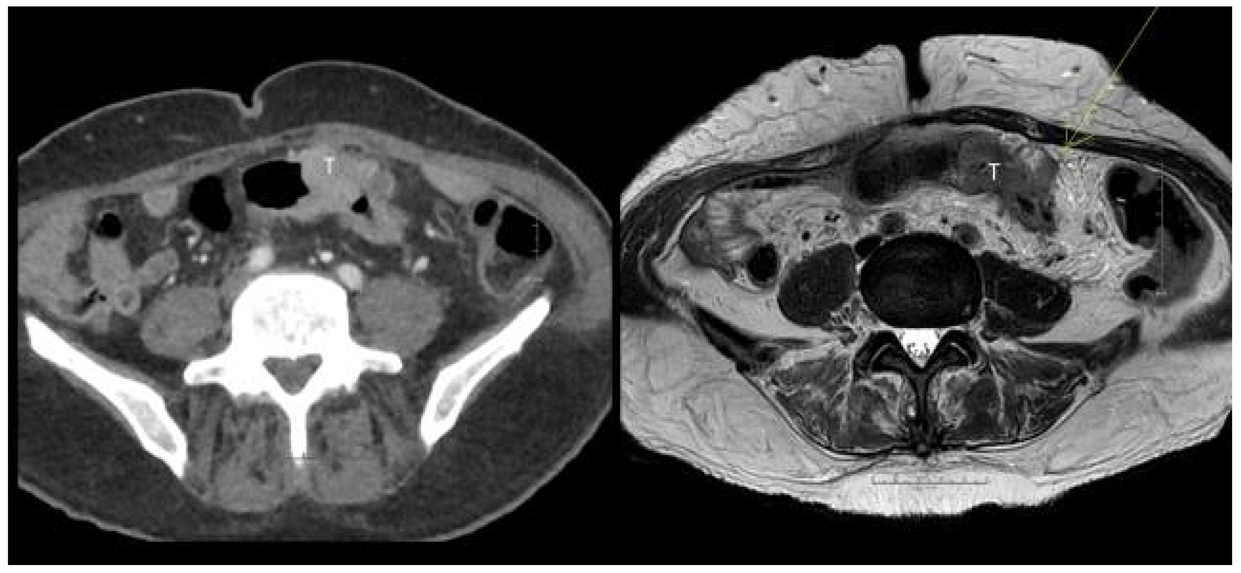 Curroncol 29 00091 g004