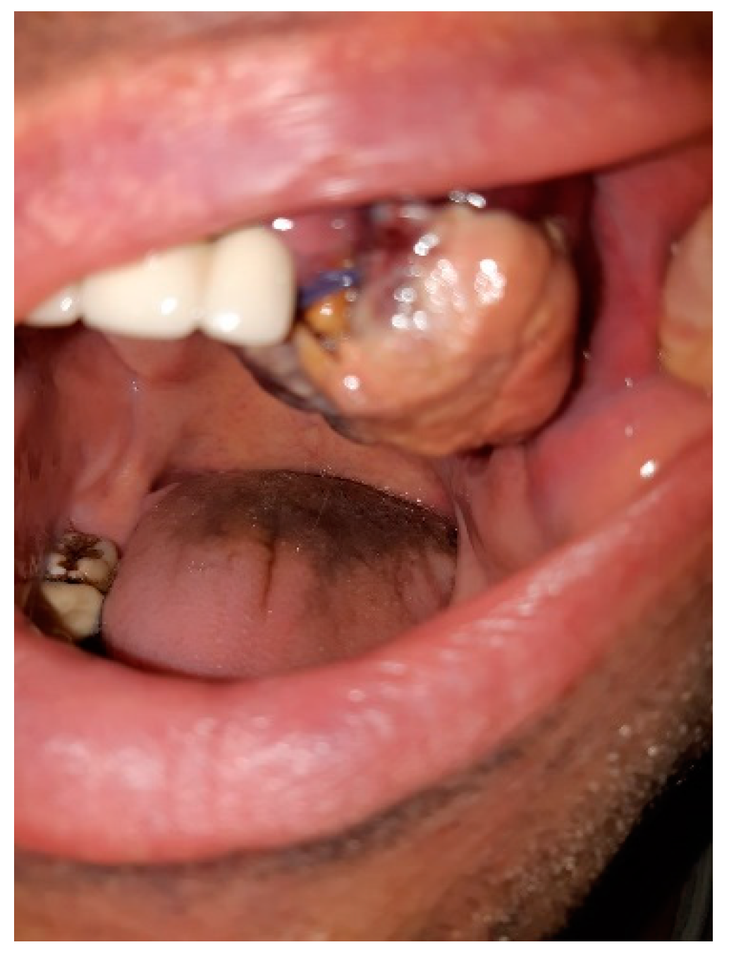 Curroncol 29 00129 g001 550