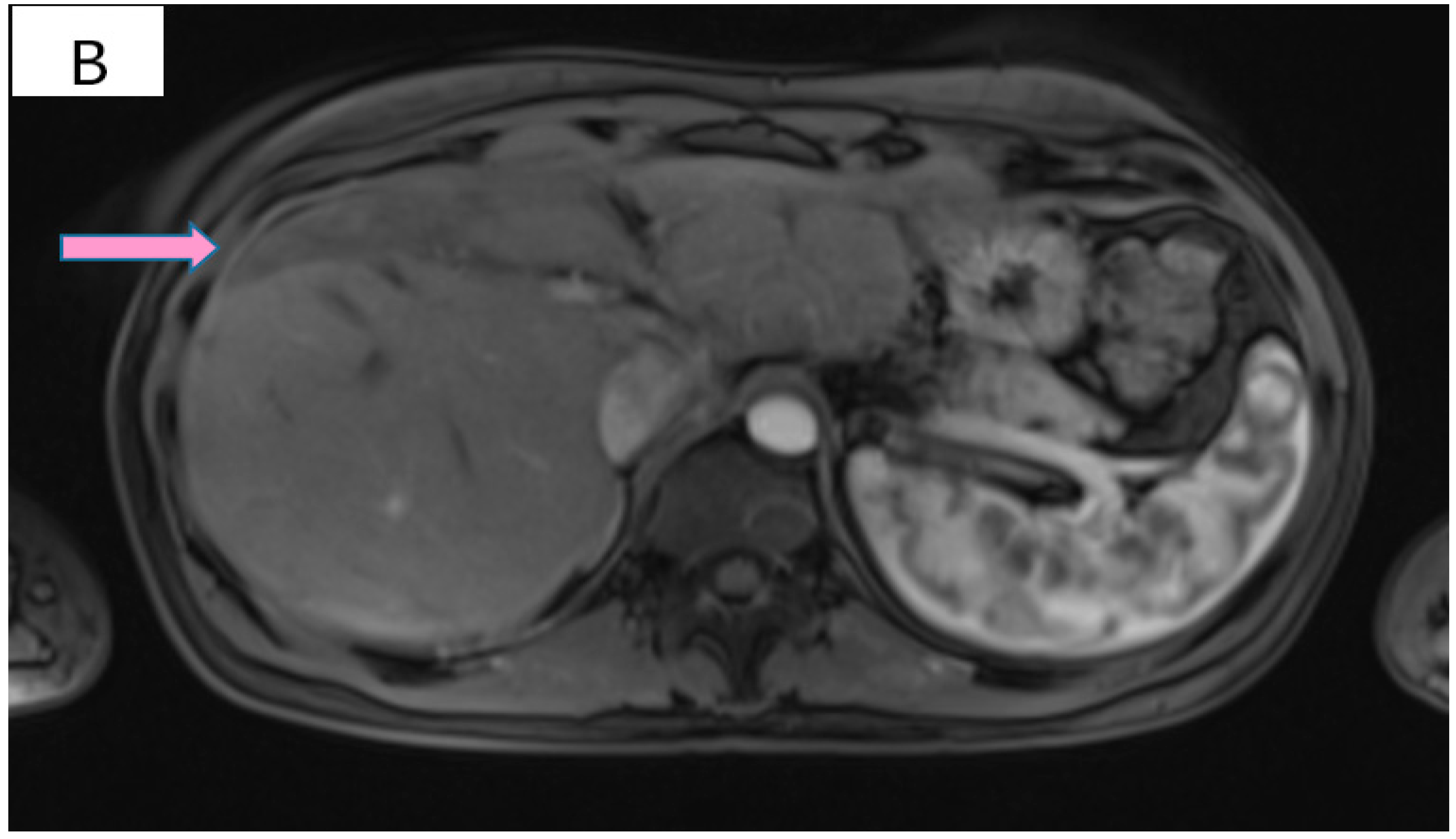 Curroncol 29 00154 g003b