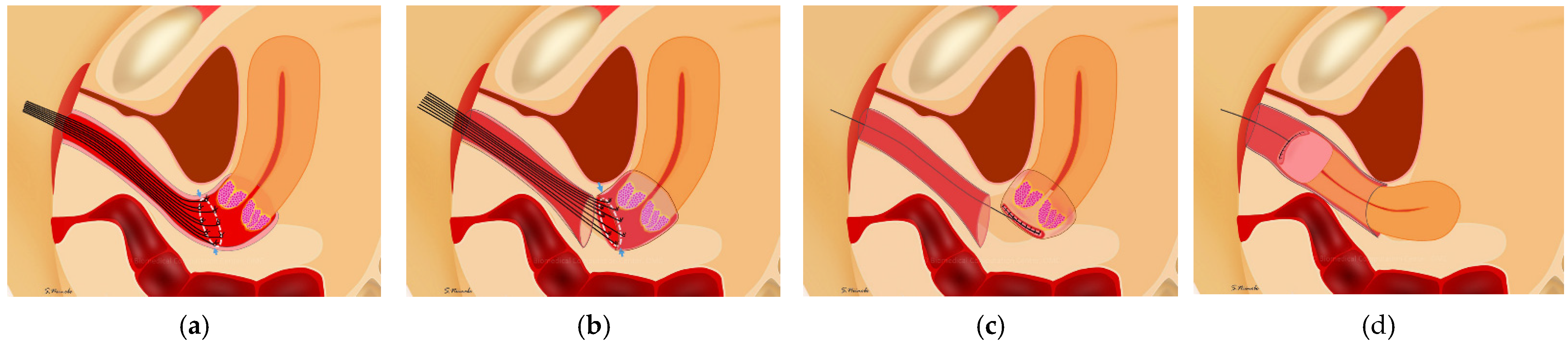 Curroncol 29 00185 g002 550