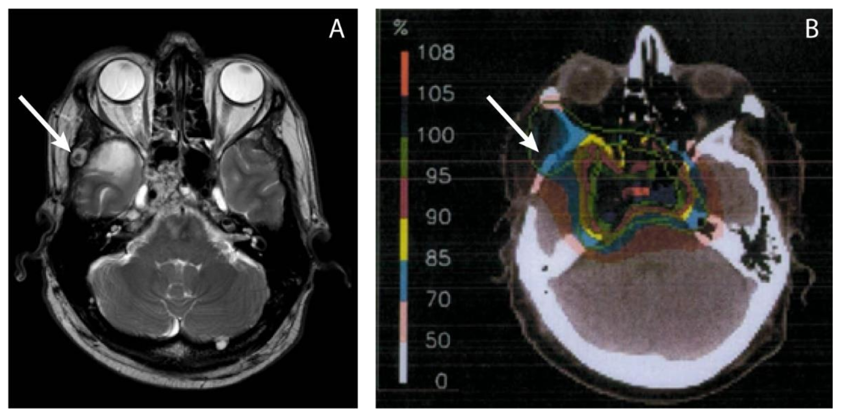 Curroncol 29 00191 g001