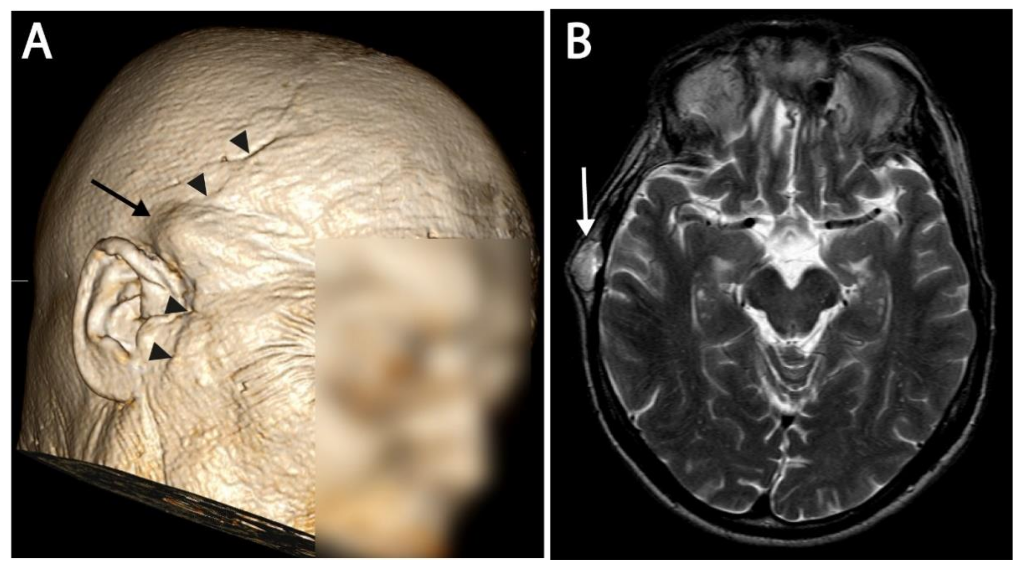 Curroncol 29 00191 g003