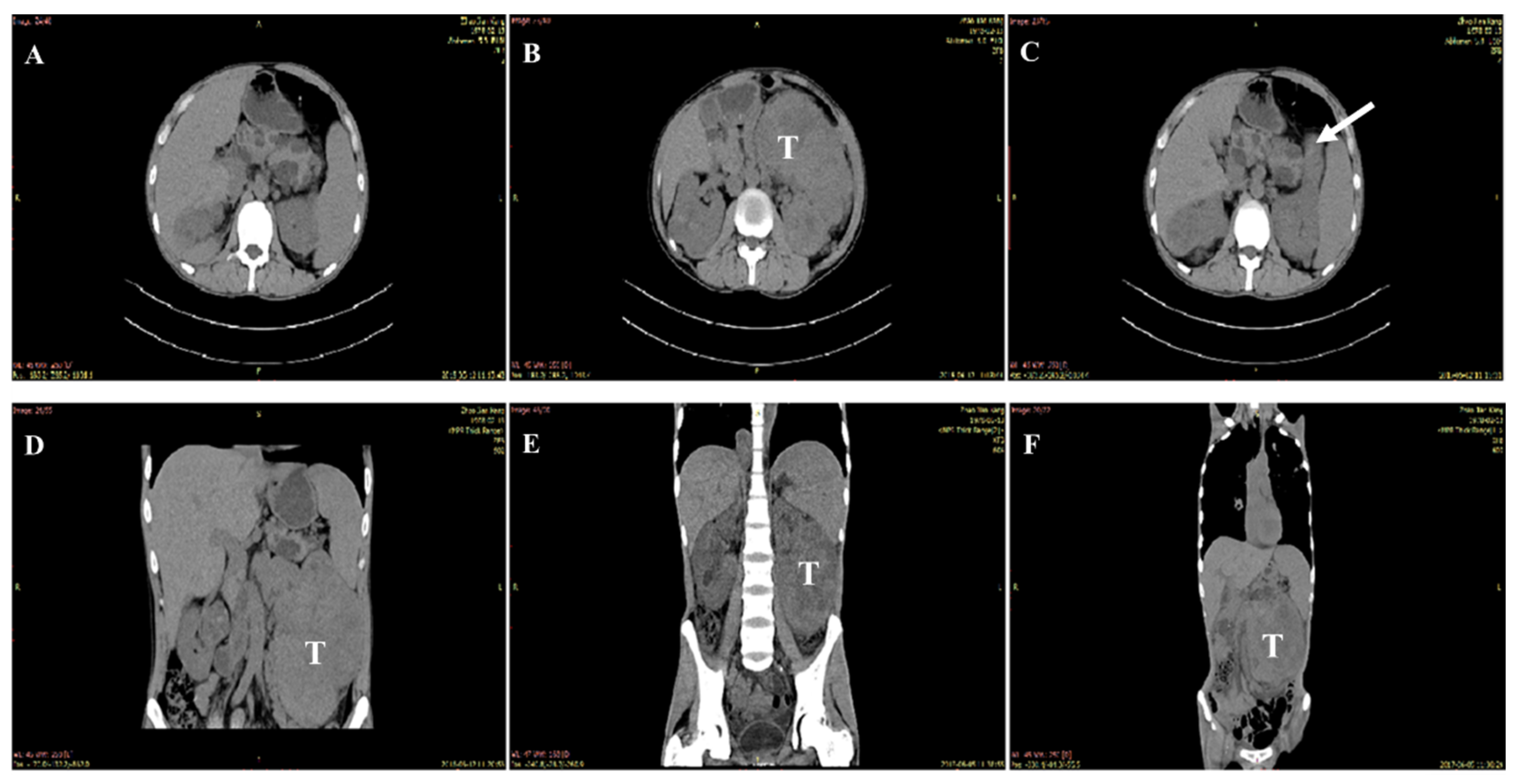 Curroncol 29 00192 g001 550
