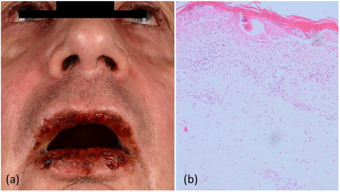 Curroncol 29 00194 g001 550