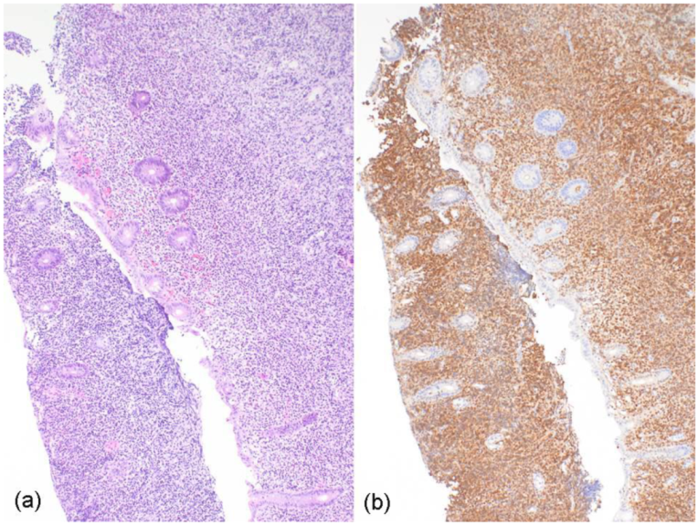 Curroncol 29 00194 g003 550