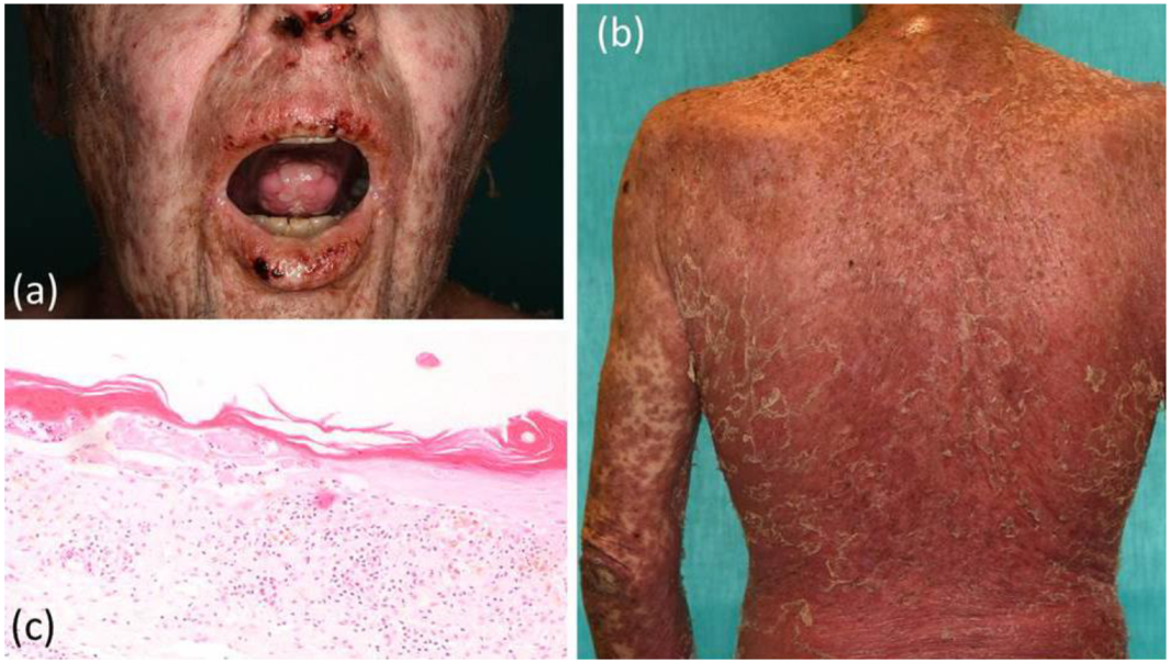 Curroncol 29 00194 g004 550