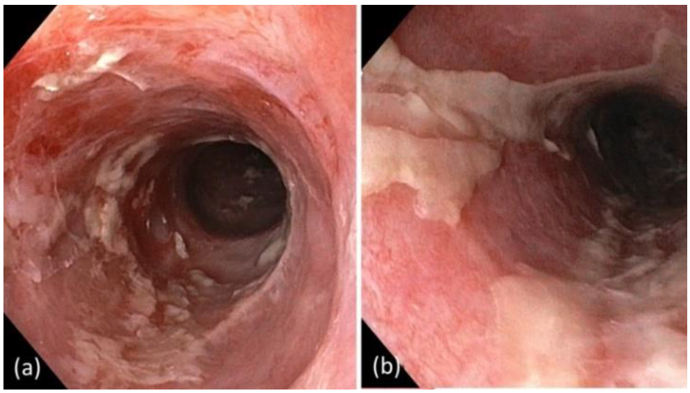 Curroncol 29 00194 g005 550