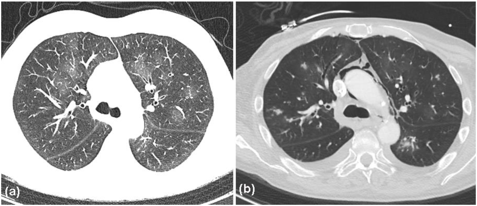 Curroncol 29 00194 g007 550
