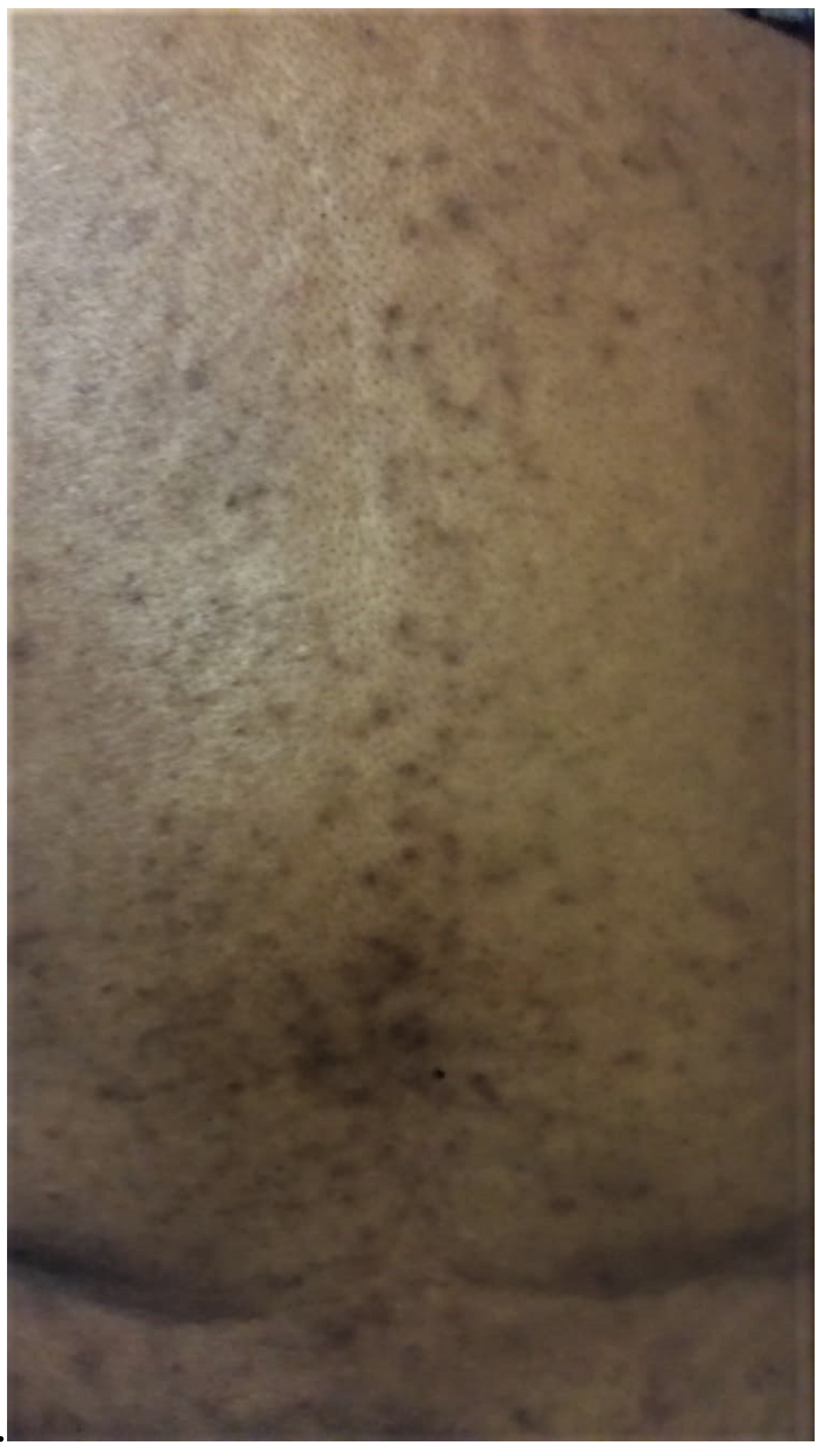 Curroncol 29 00205 g001 550