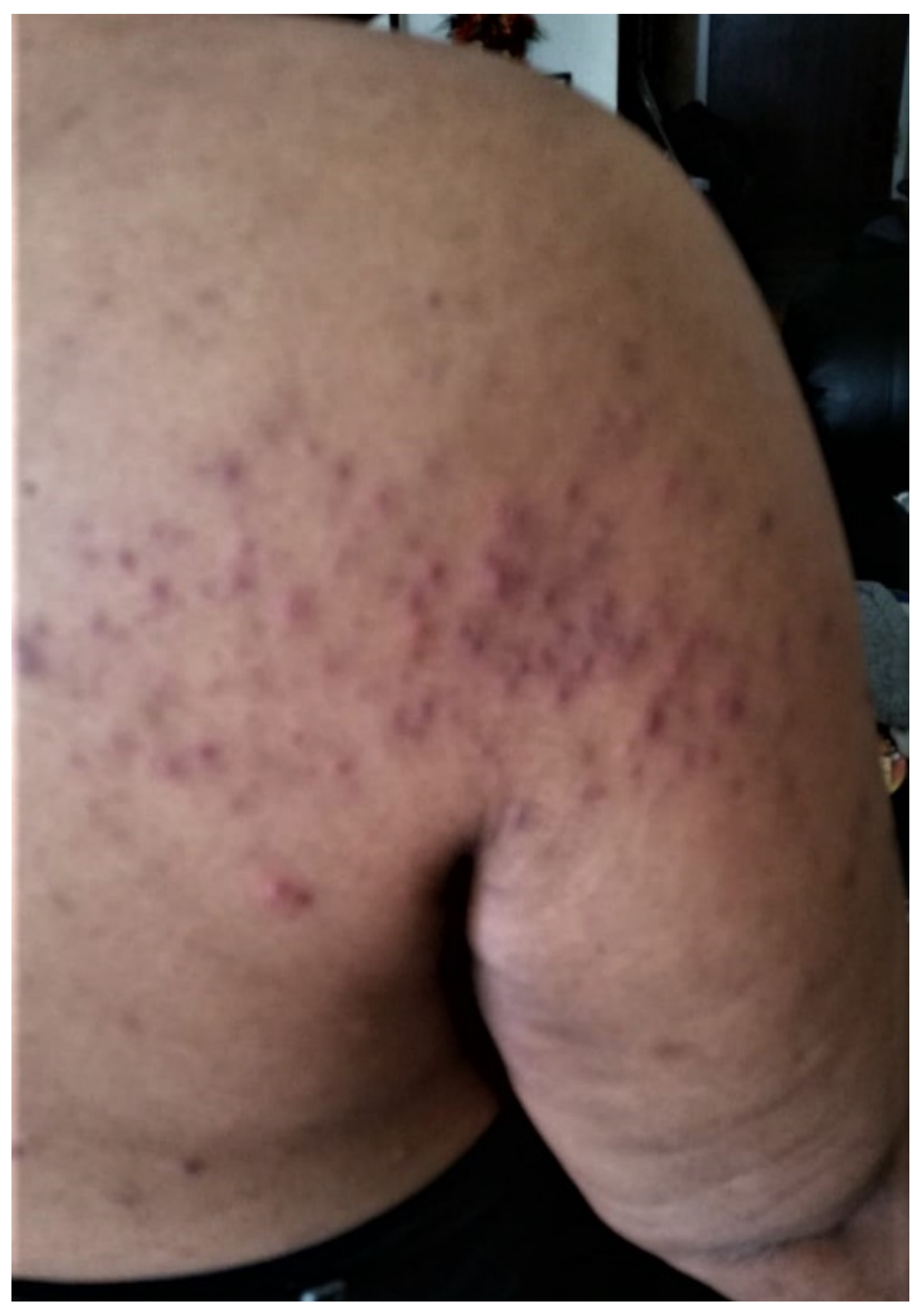 Curroncol 29 00205 g002 550