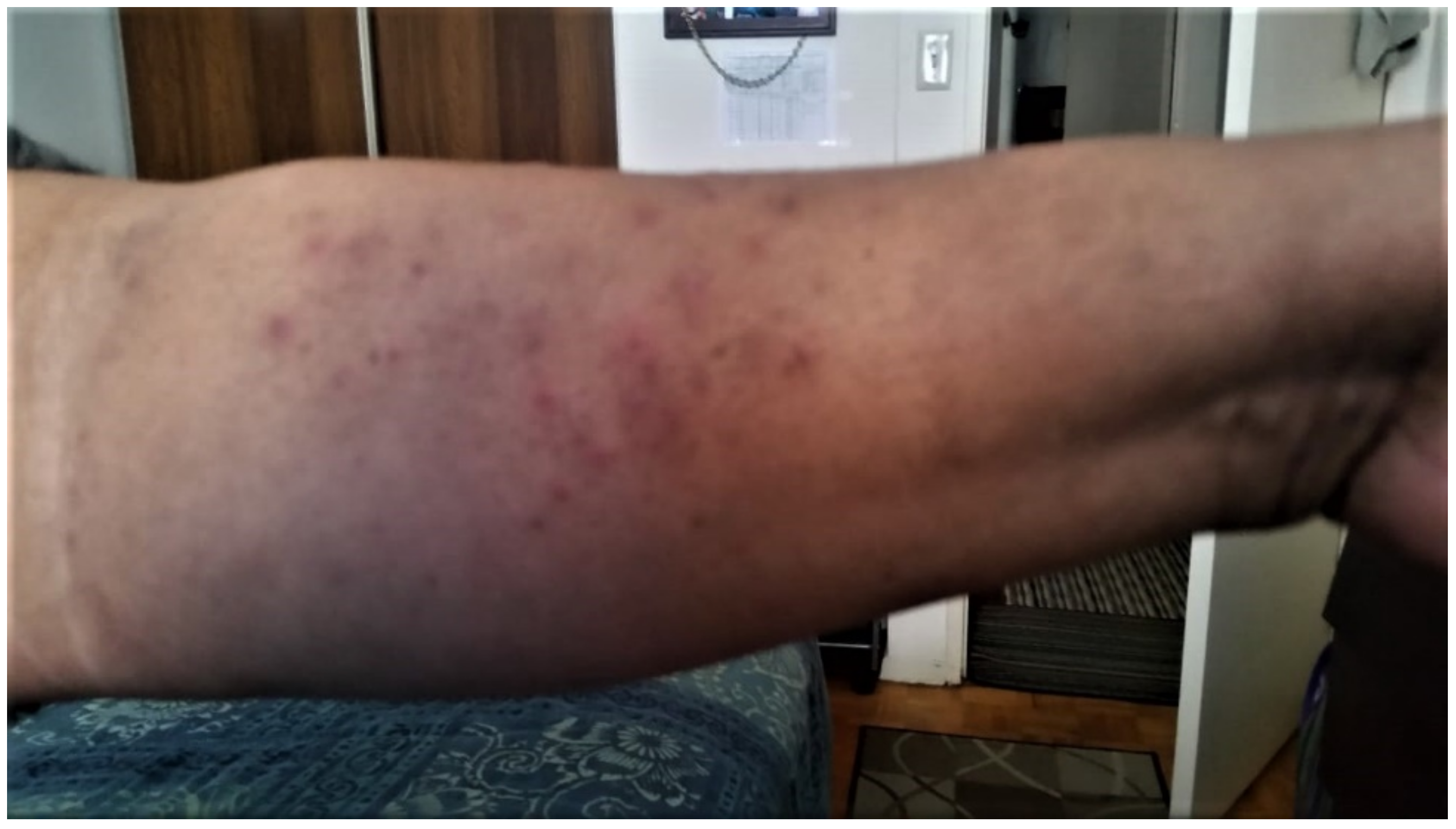 Curroncol 29 00205 g003 550