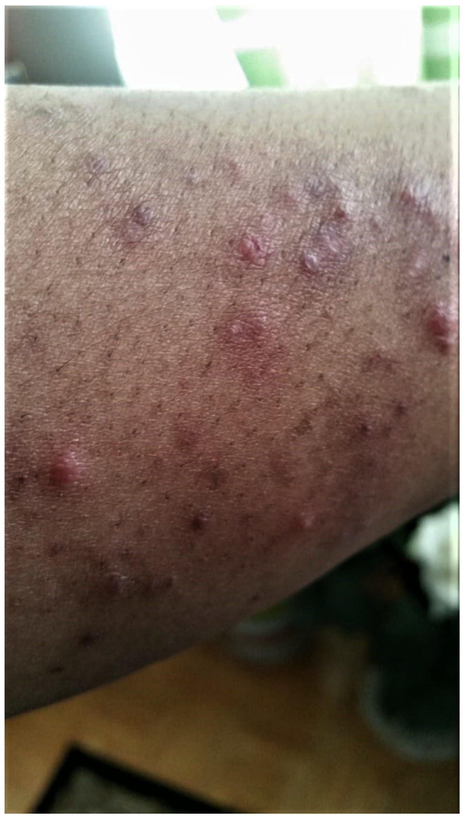 Curroncol 29 00205 g004 550