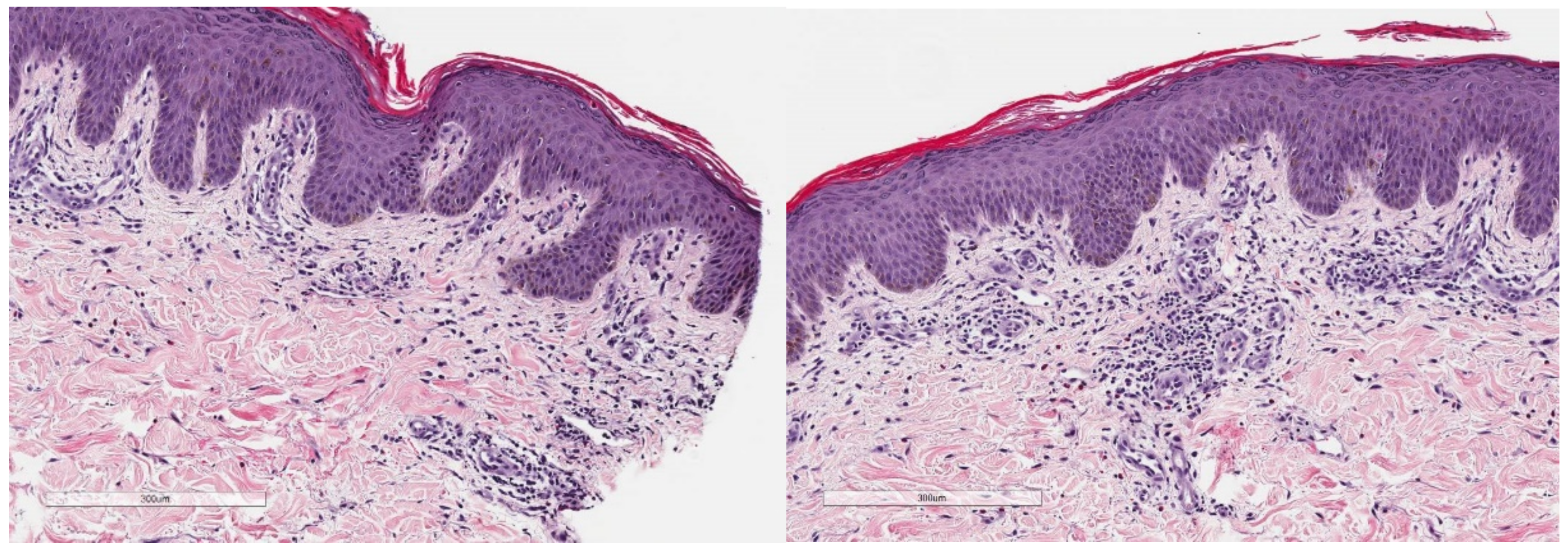 Curroncol 29 00205 g005 550