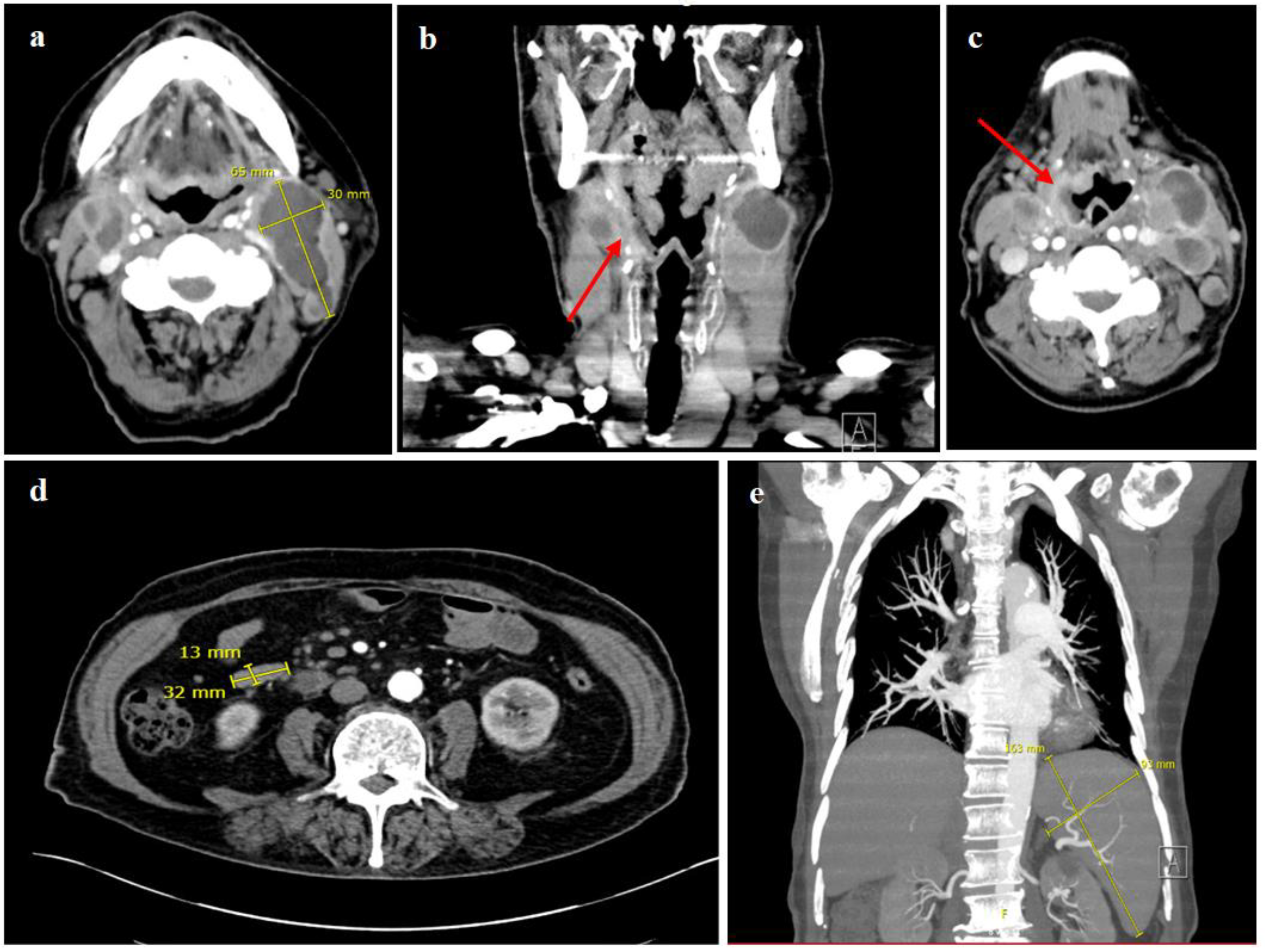 Curroncol 29 00224 g002