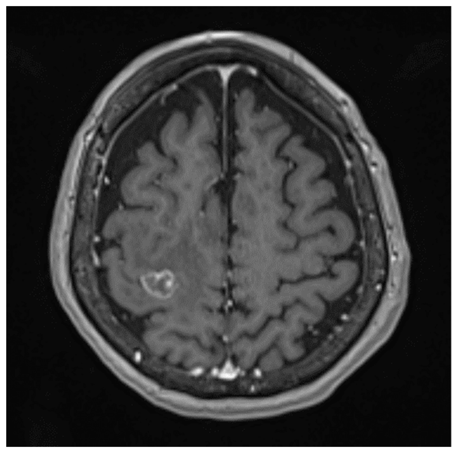 Curroncol 29 00228 g001