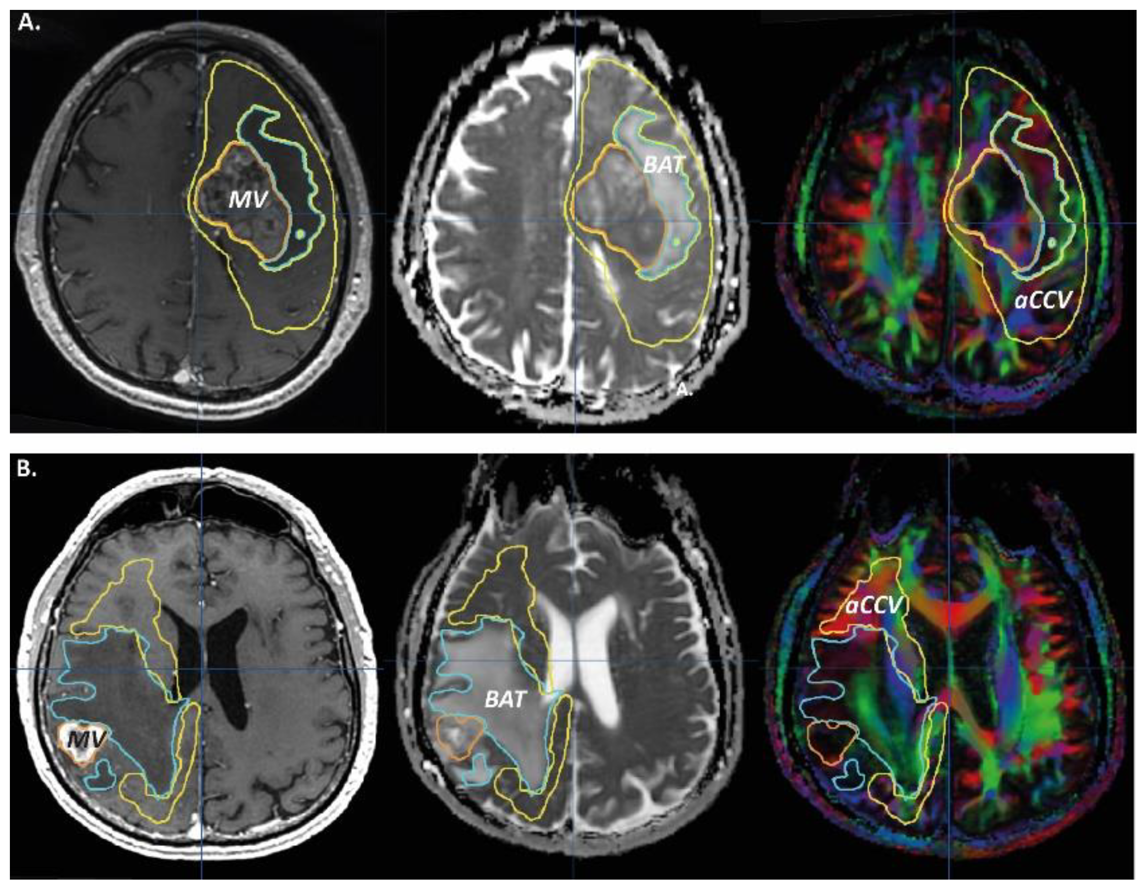 Curroncol 29 00230 g002