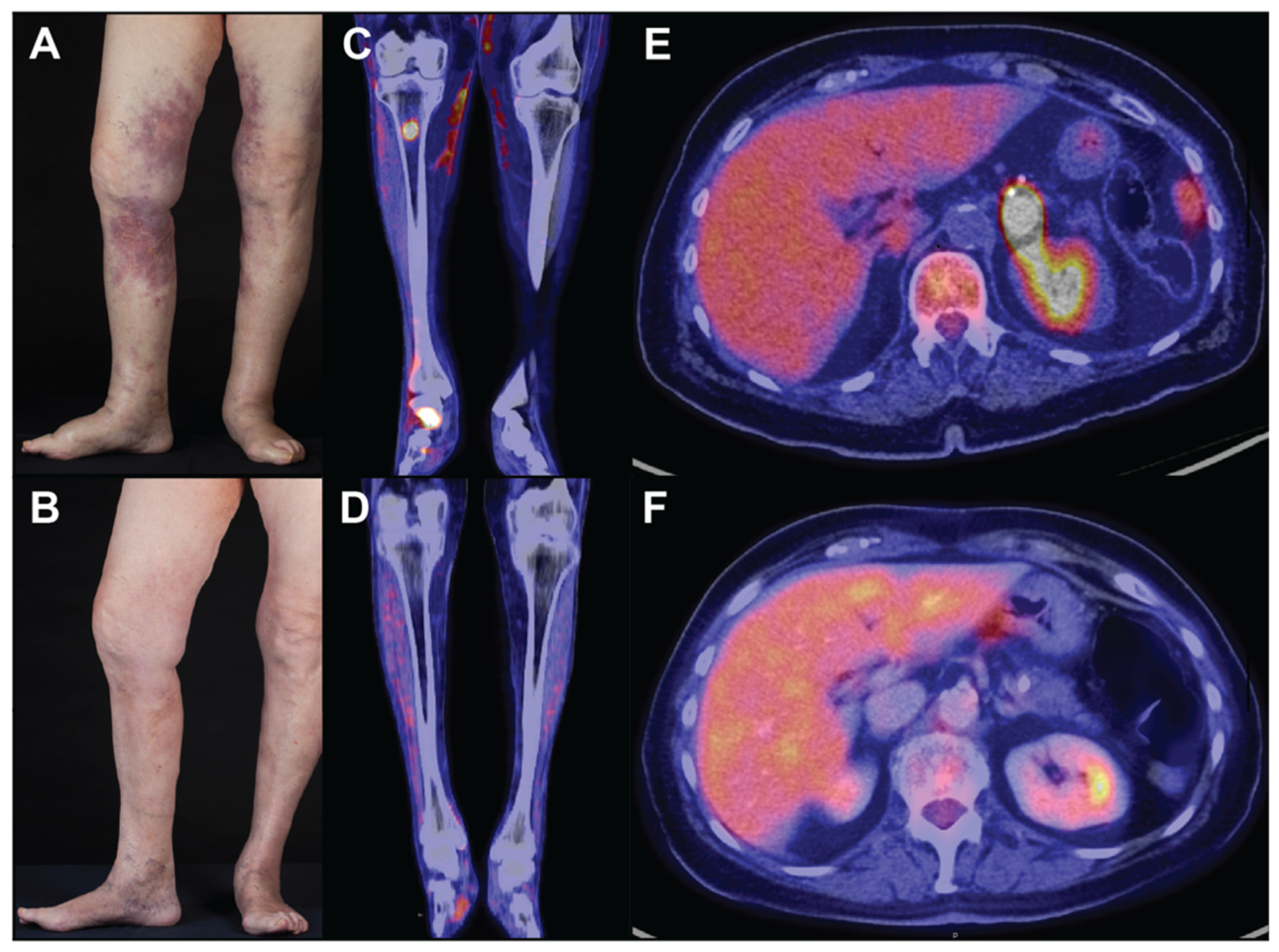 Curroncol 29 00237 g001 550