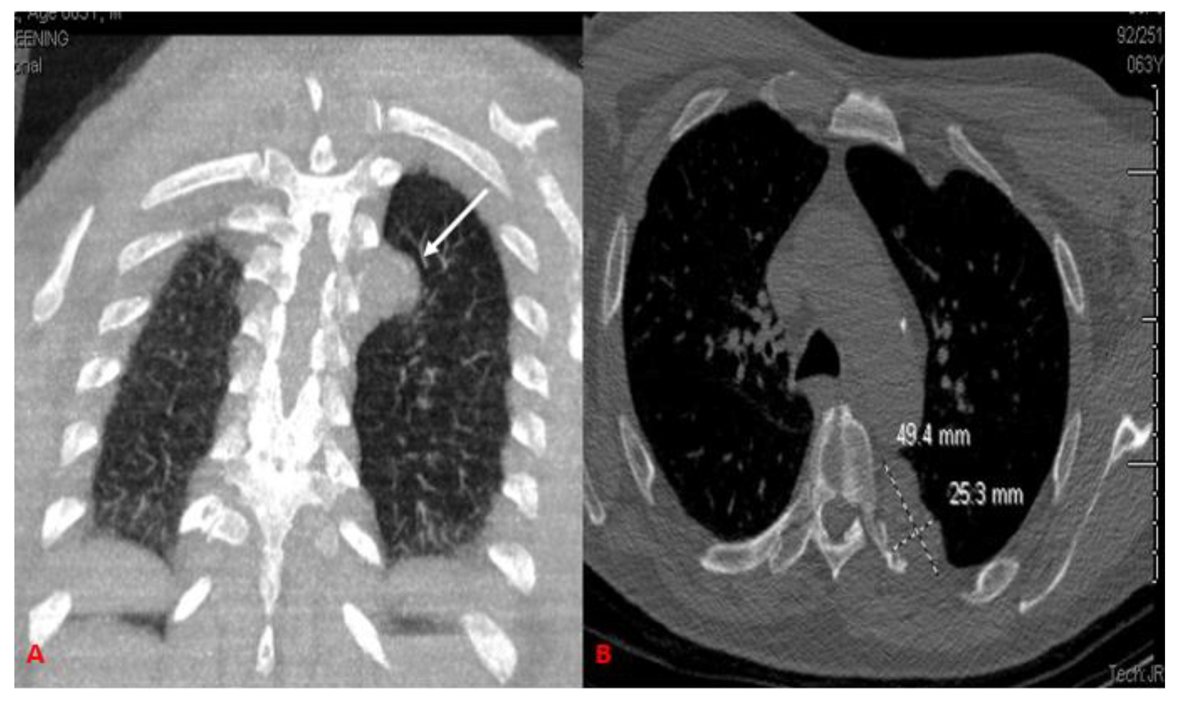 Curroncol 29 00240 g001 Curroncol 29 00240 g001