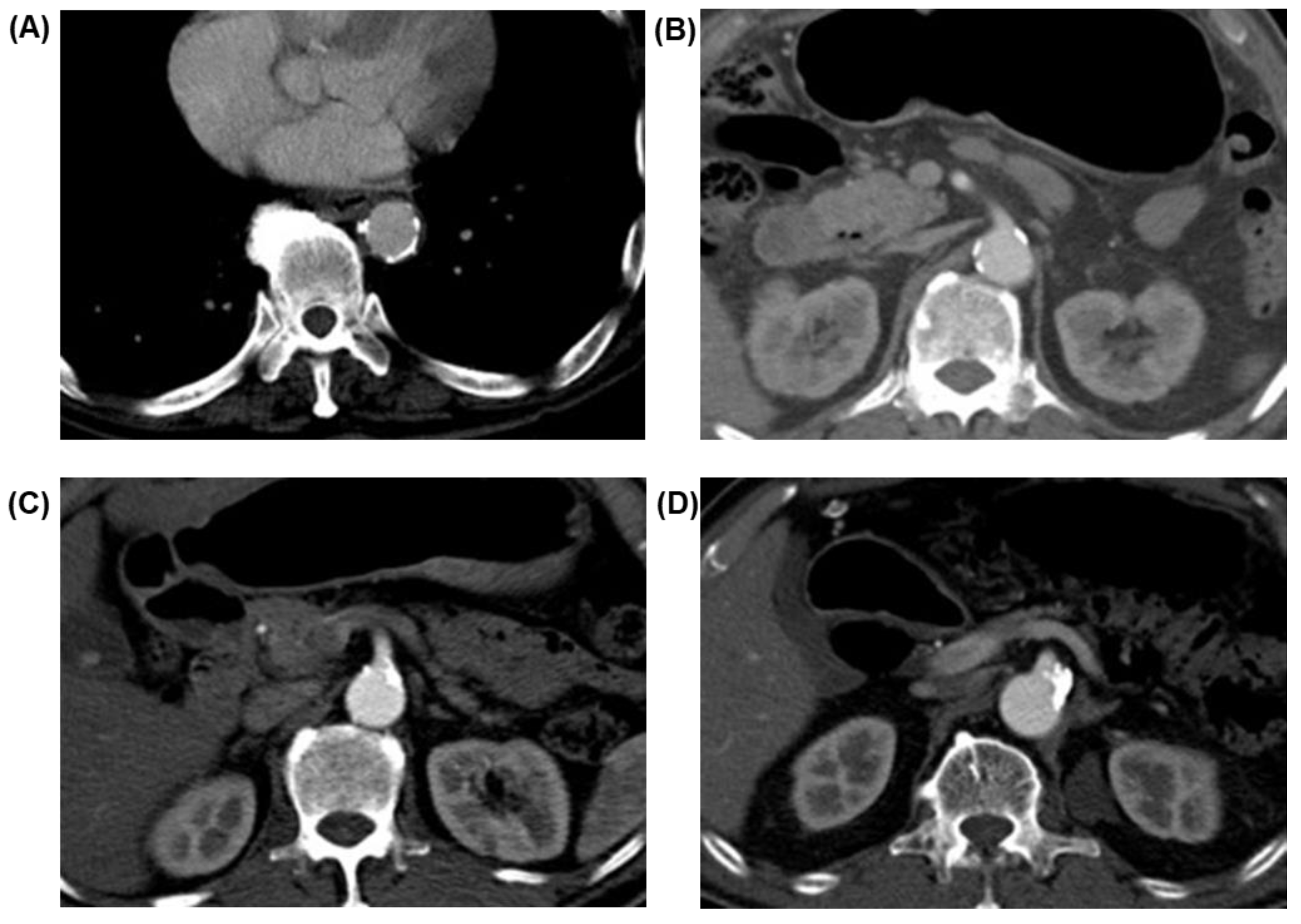Curroncol 29 00262 g001 Curroncol 29 00262 g001