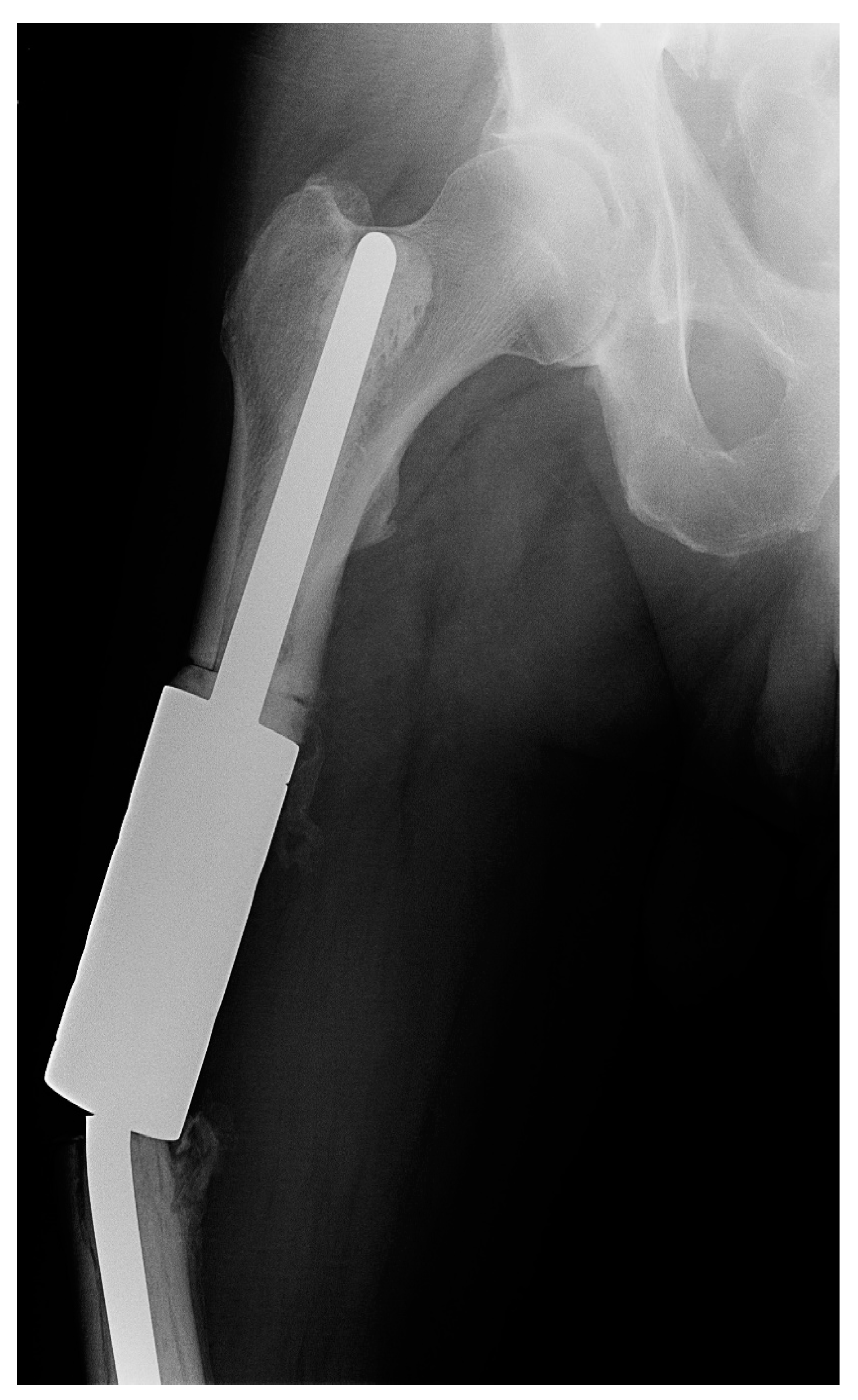 Curroncol 29 00284 g004