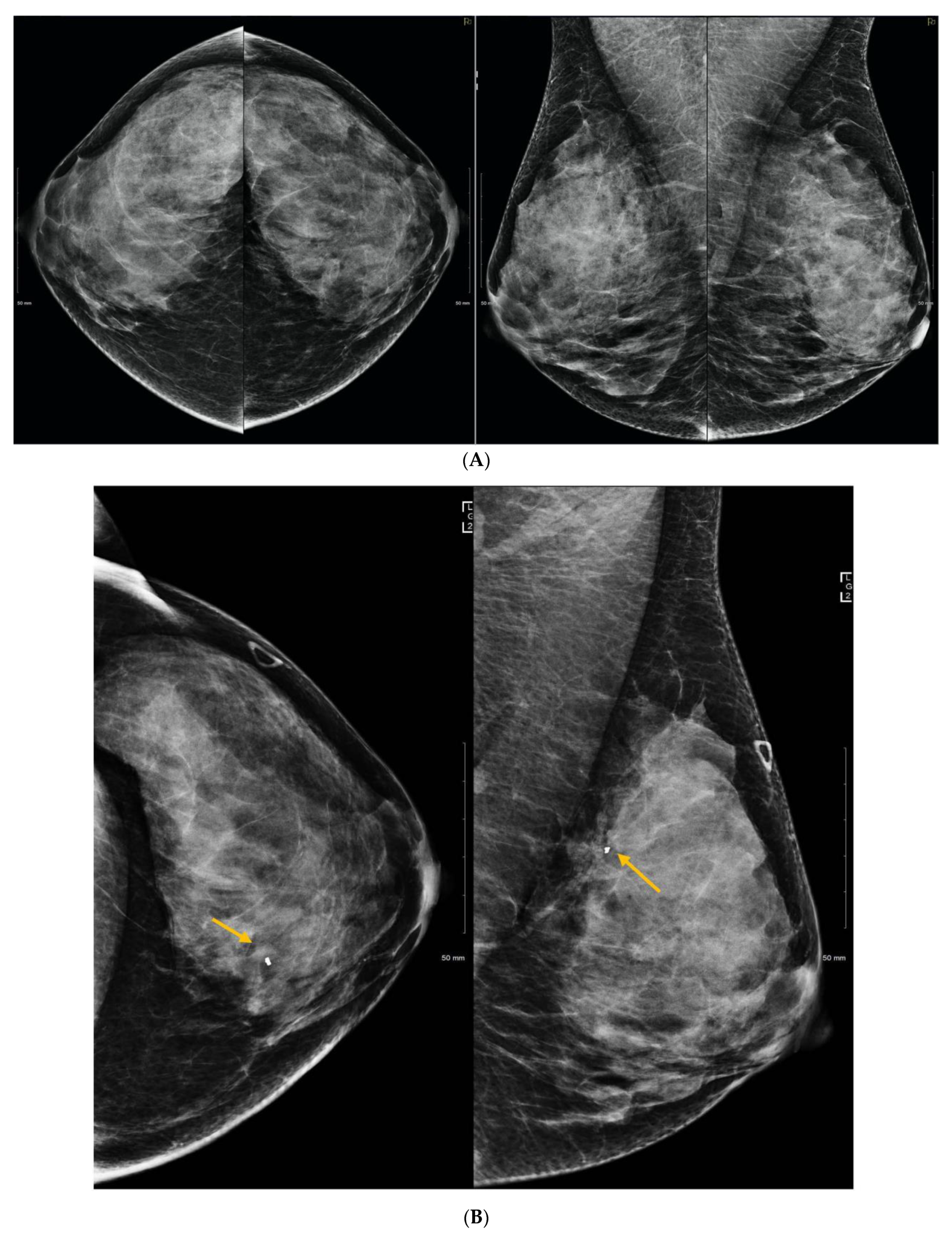 Curroncol 29 00291 g002a Curroncol 29 00291 g002a