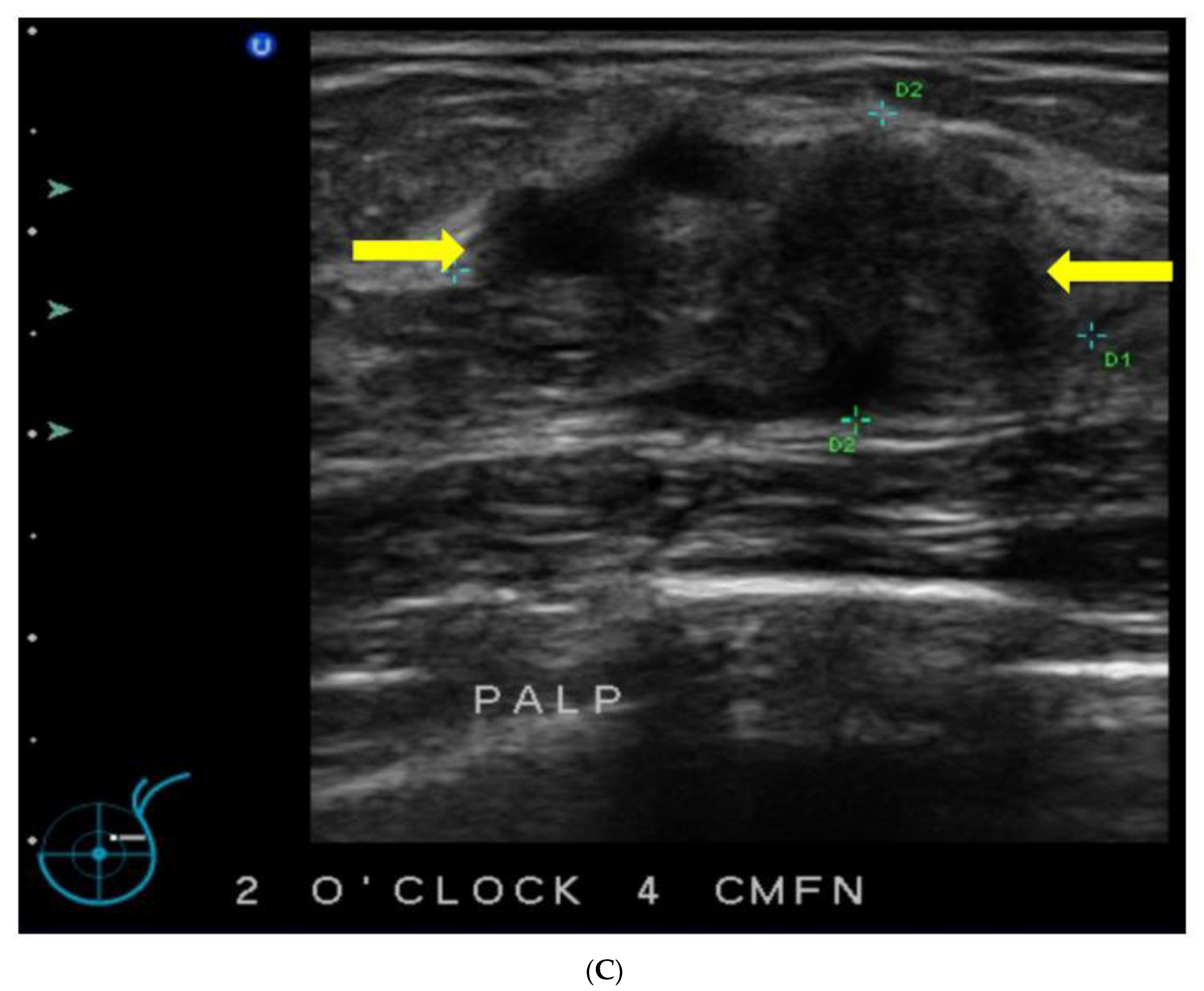 Curroncol 29 00291 g002b Curroncol 29 00291 g002b