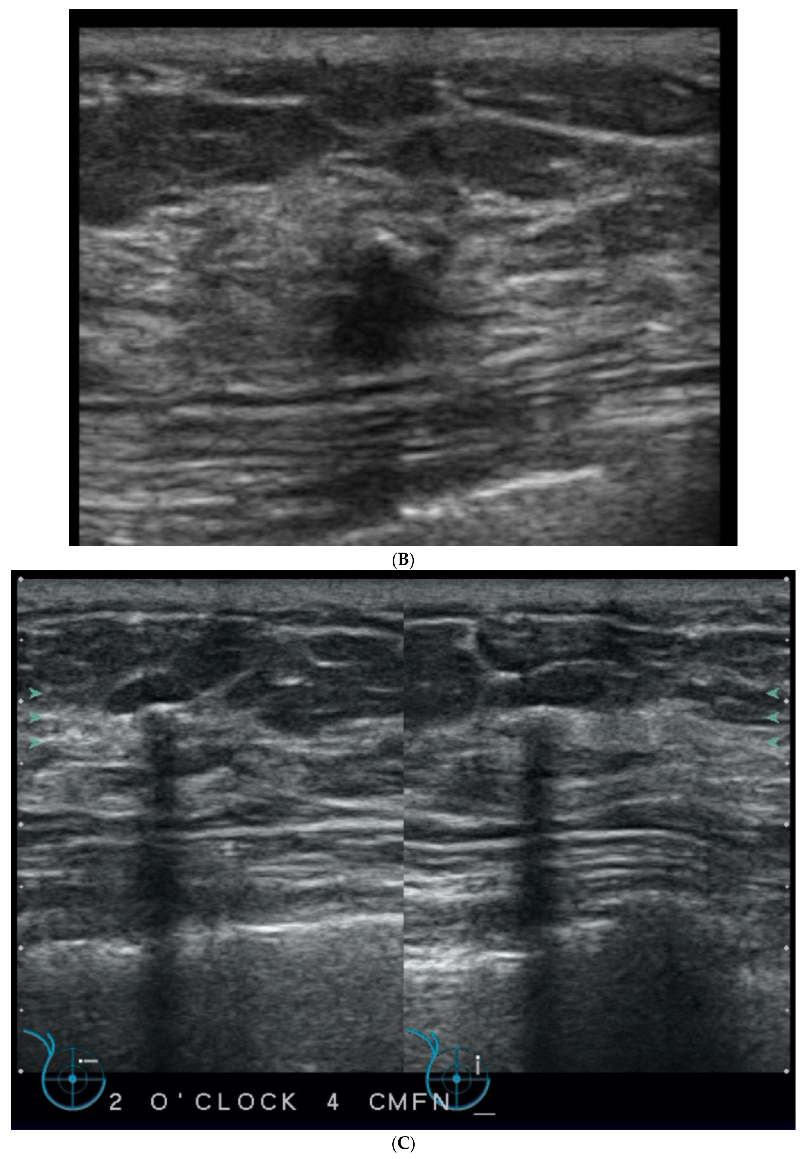 Curroncol 29 00291 g003b Curroncol 29 00291 g003b