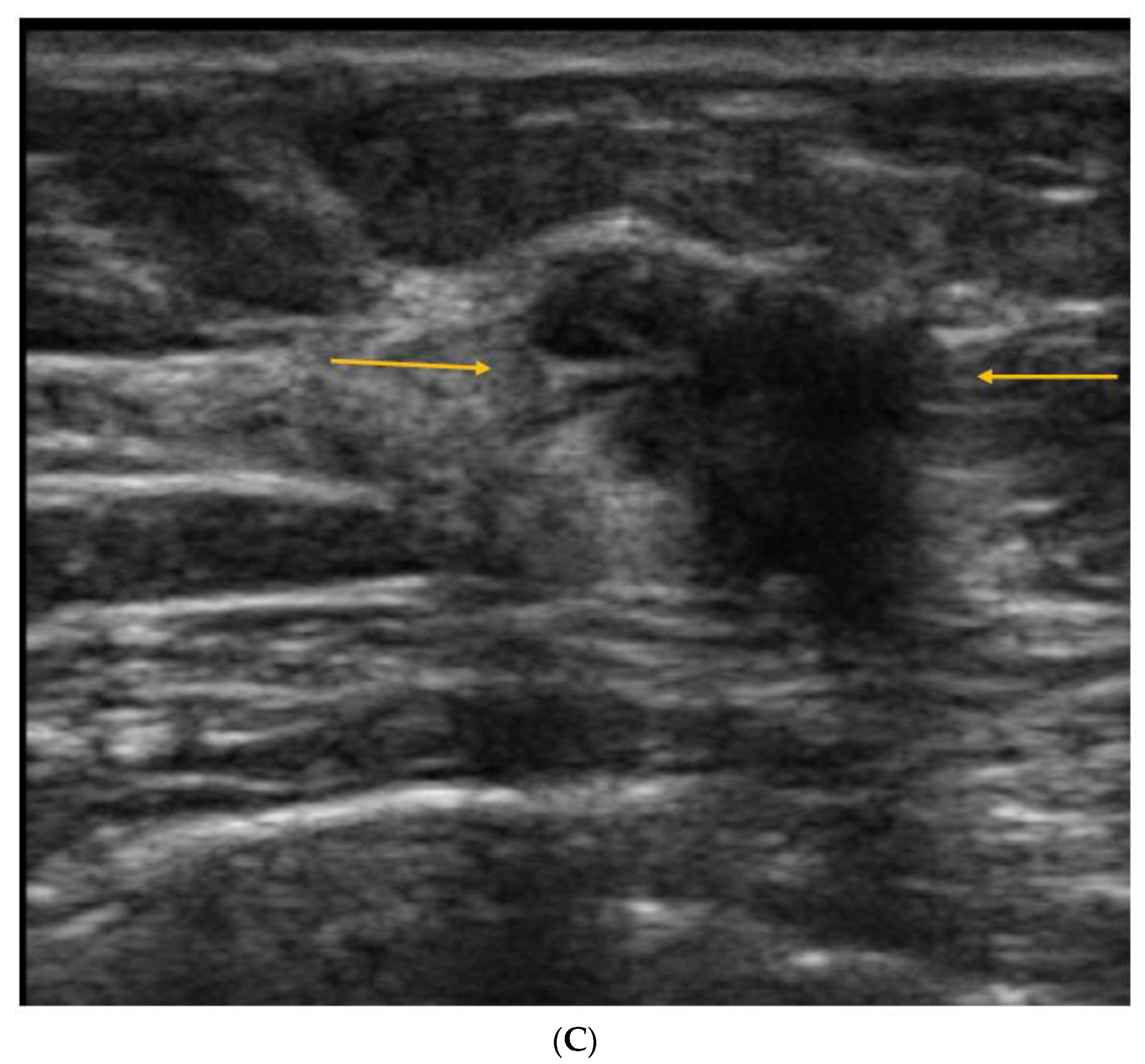 Curroncol 29 00291 g004b Curroncol 29 00291 g004b